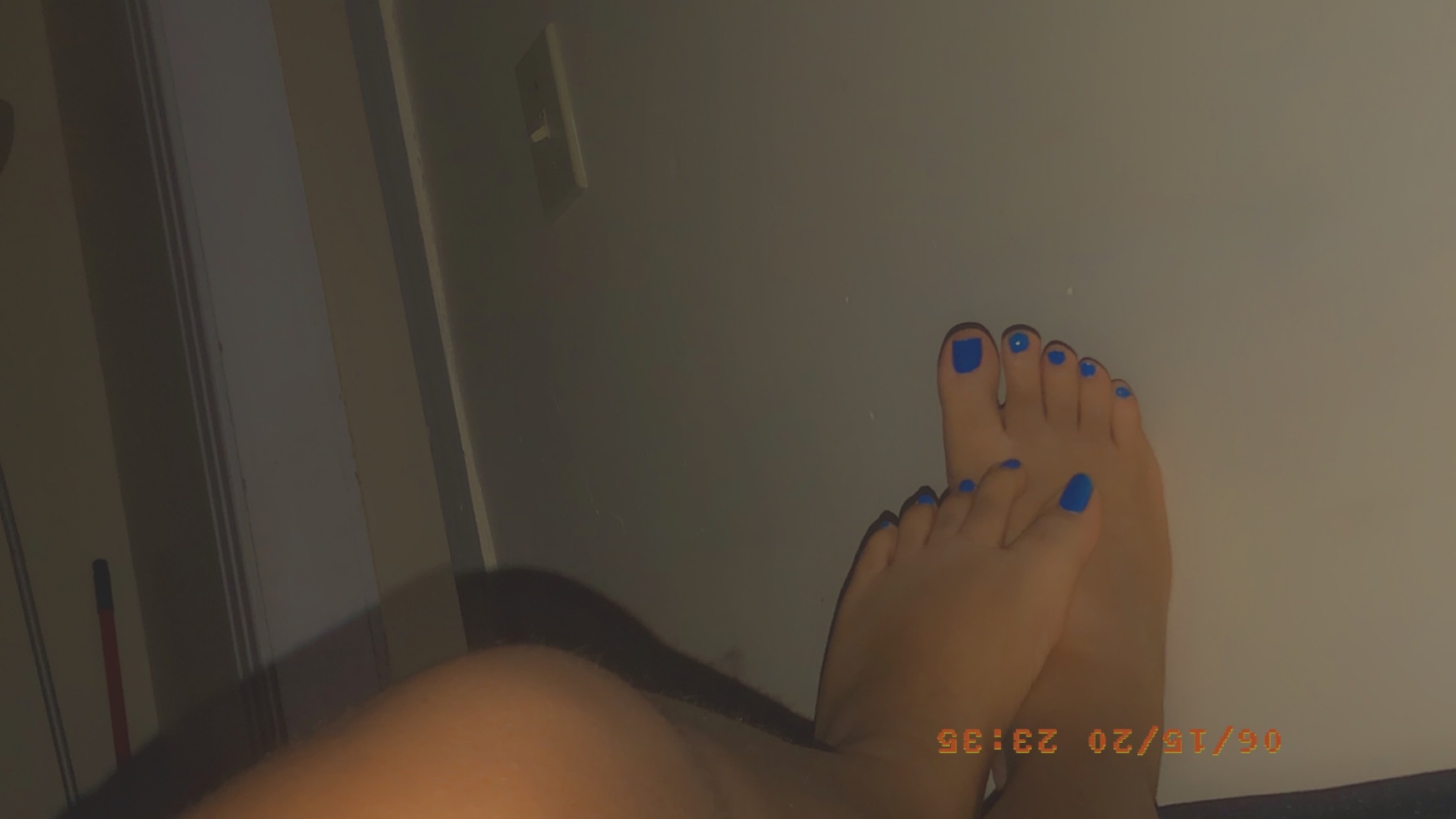 Mylightskinfeet profile