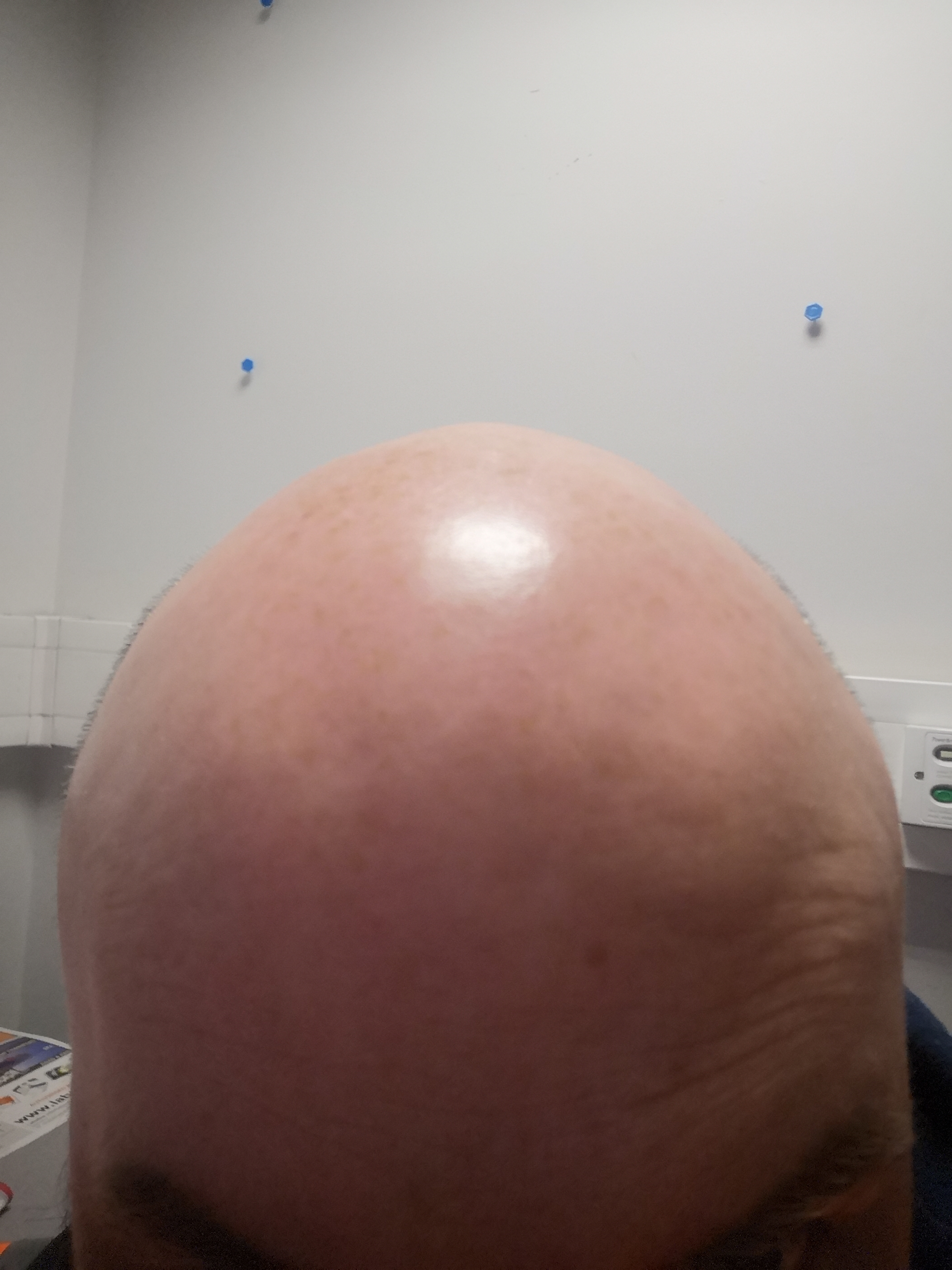 embracethebald thumbnail