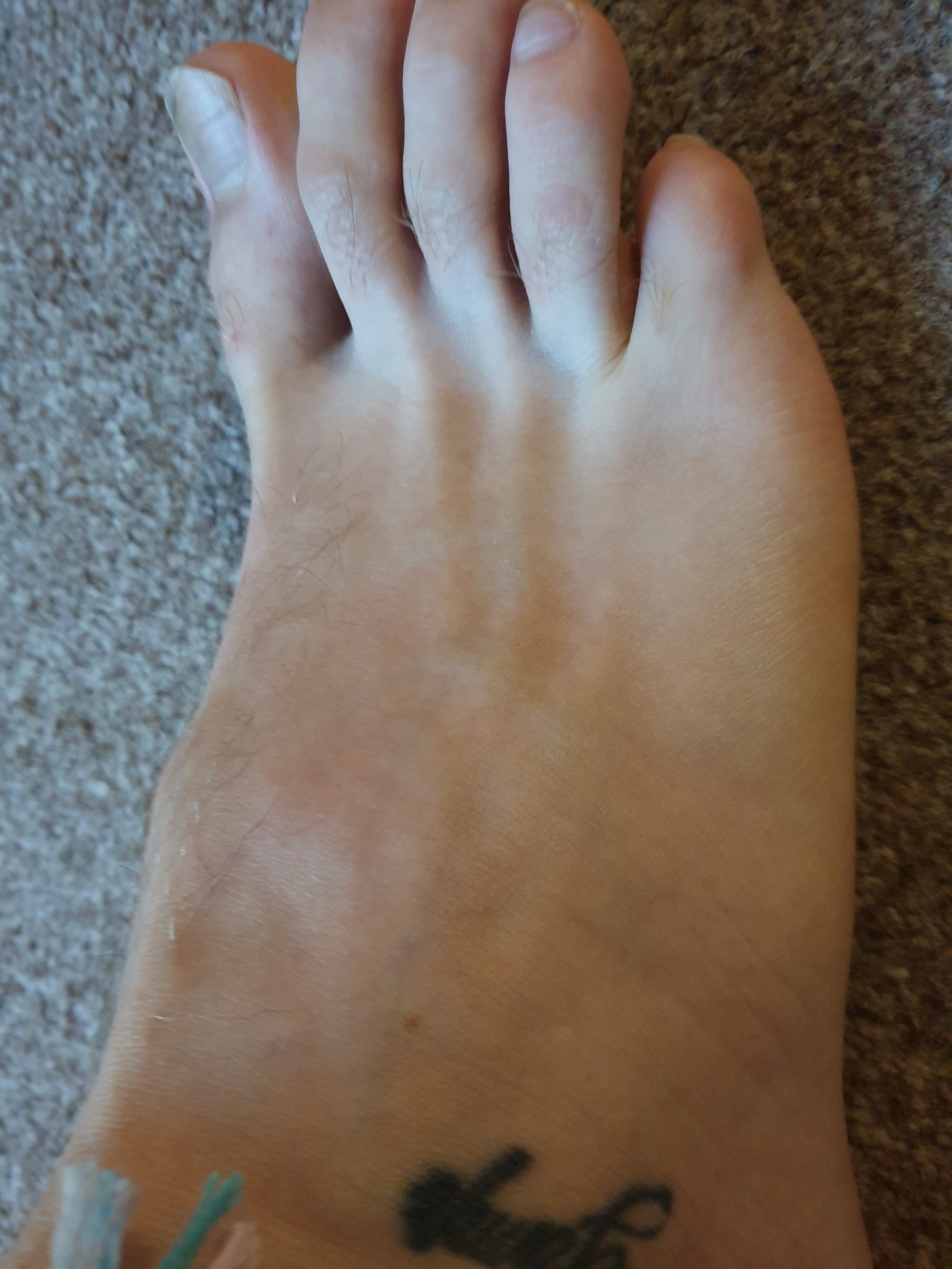 toesfordays profile