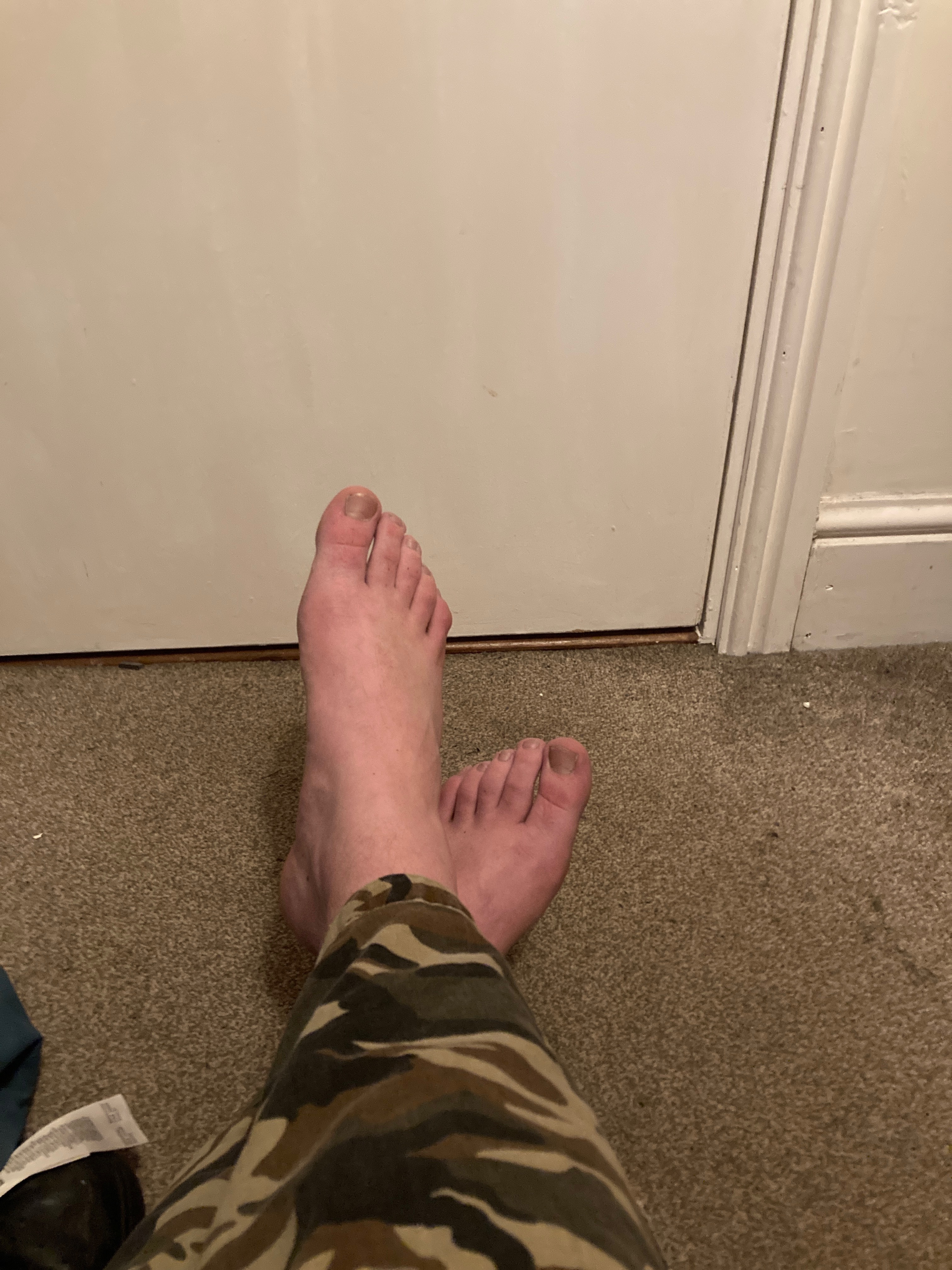 londonfeet4ucover