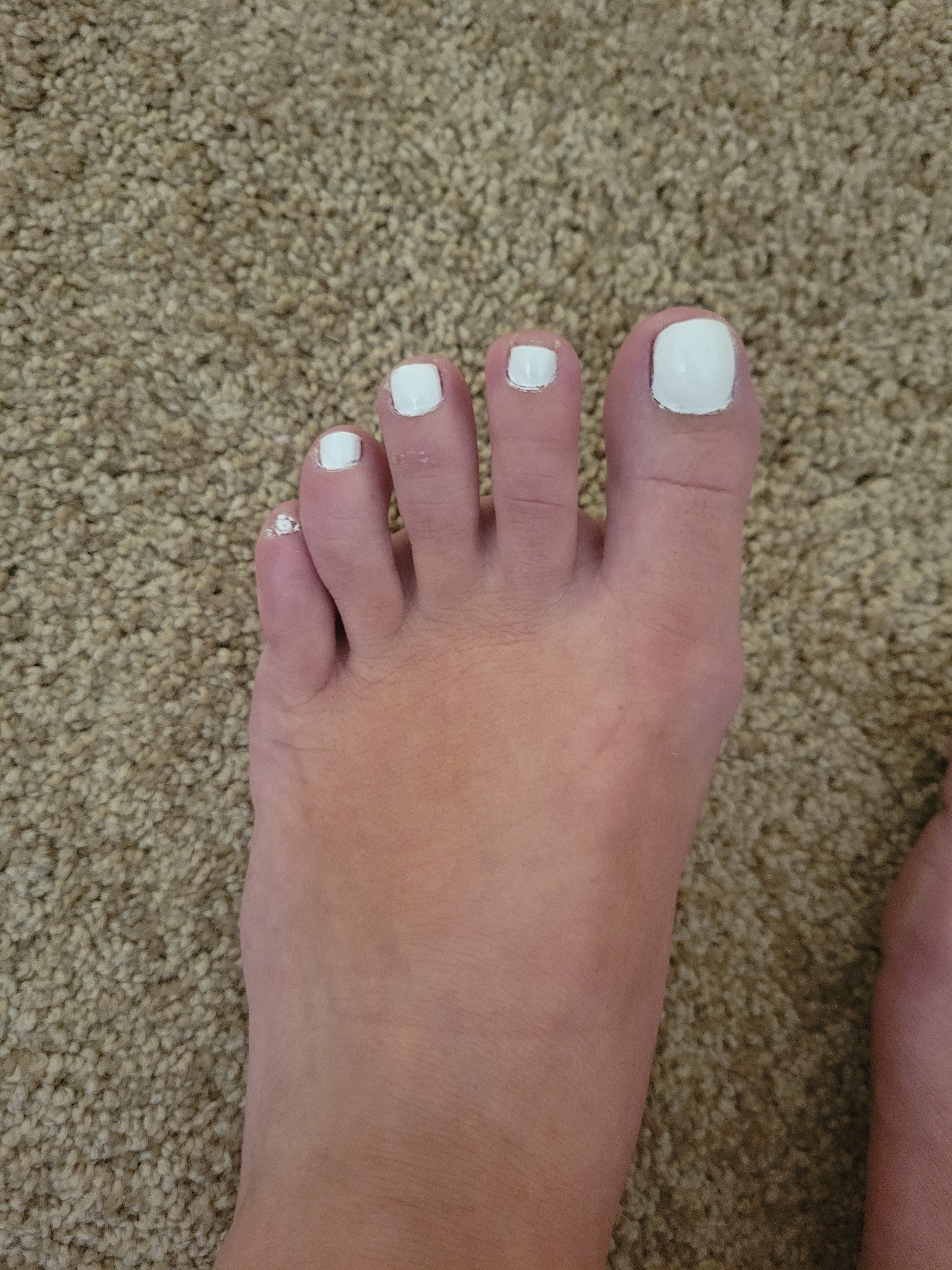 Tinytoes profile