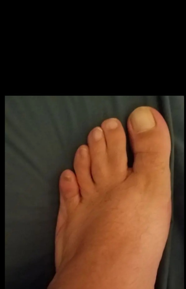 Foot of luck thumbnail