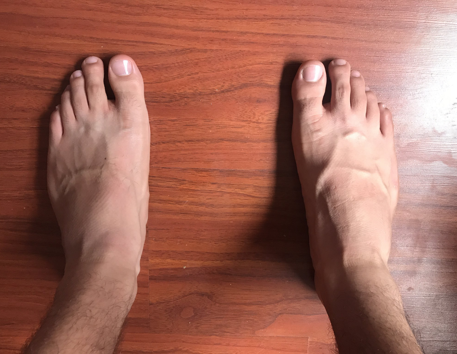 colombianfeet99 thumbnail