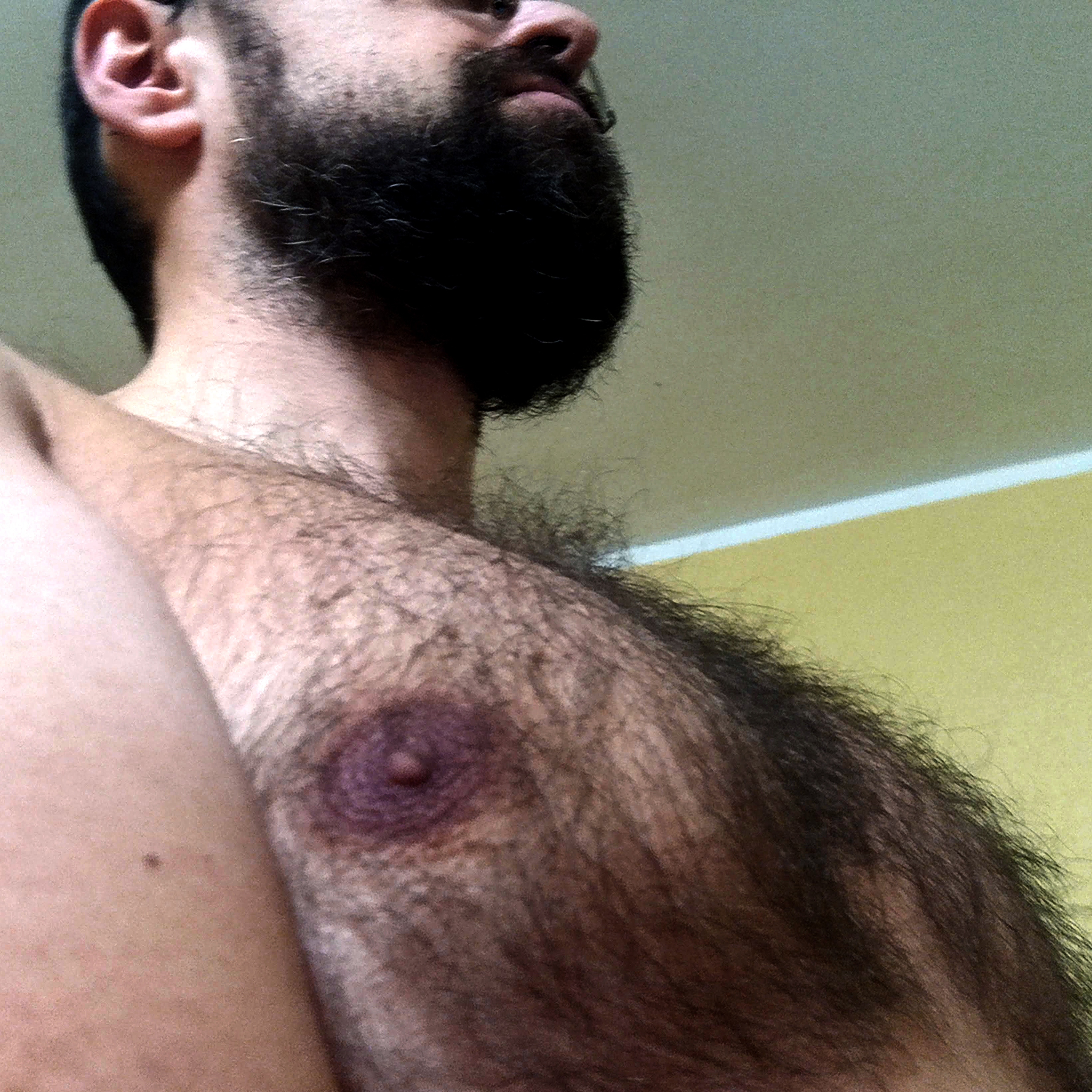 hairyteddy76vipcover