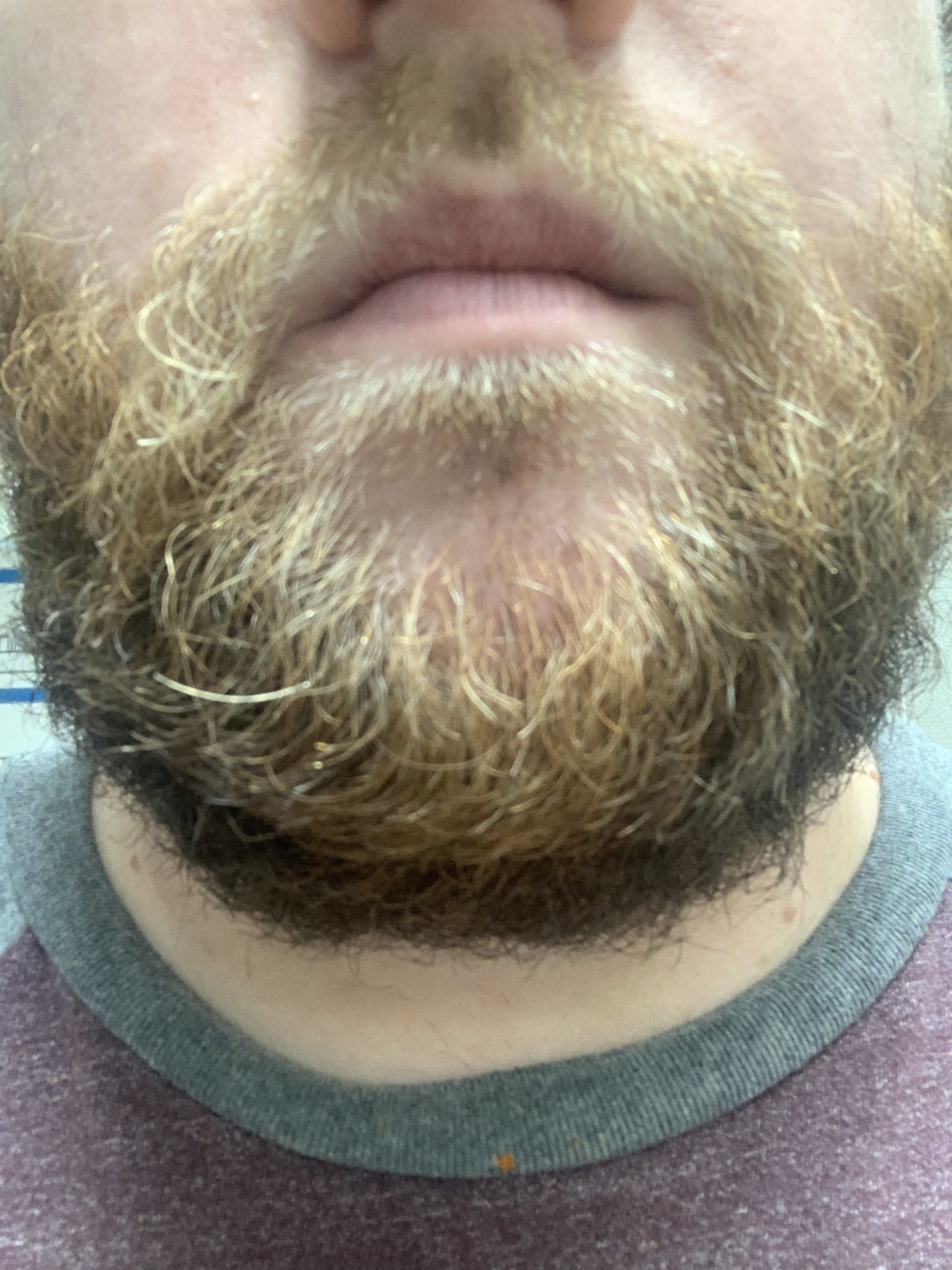 erabeard thumbnail