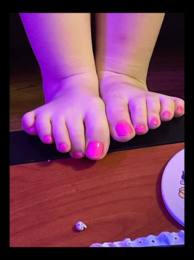 feetsgaloregirls thumbnail