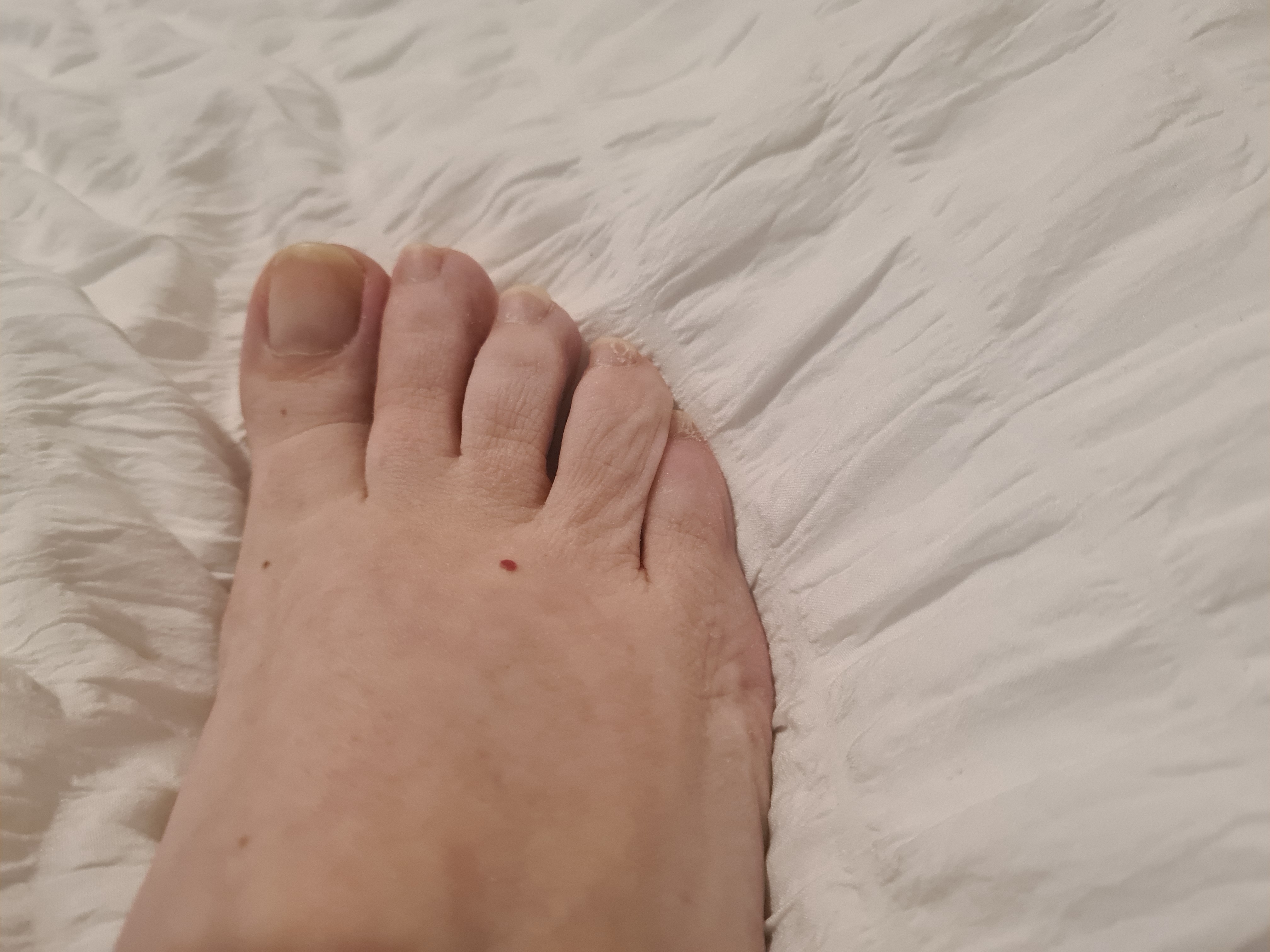 Toostie Toes thumbnail