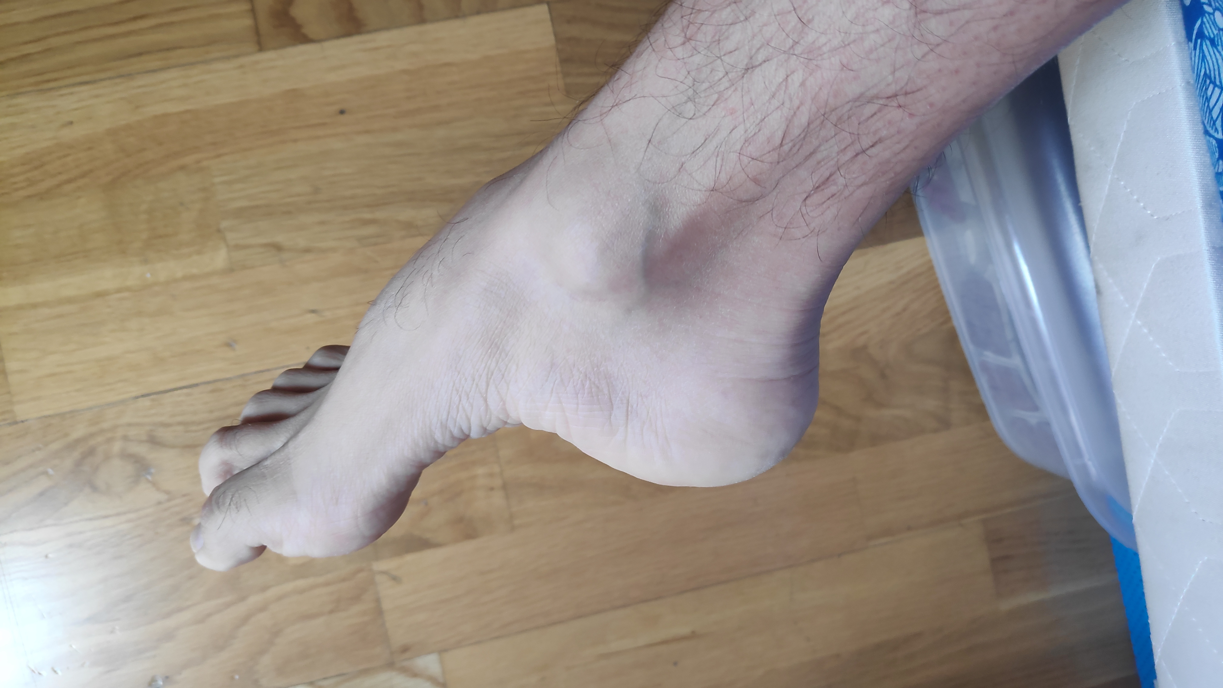 mancavussfeet thumbnail