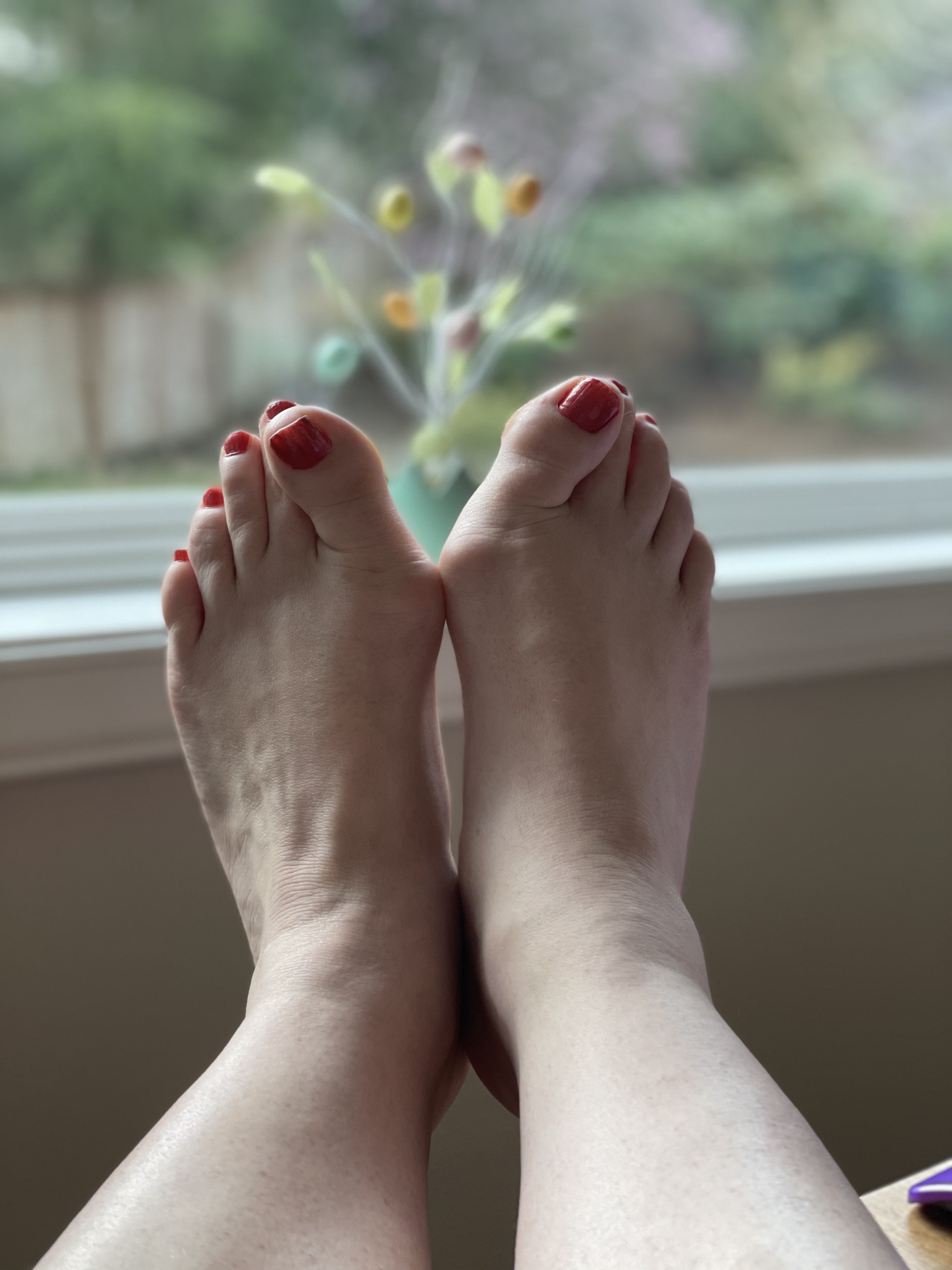 Marissa Bunions profile