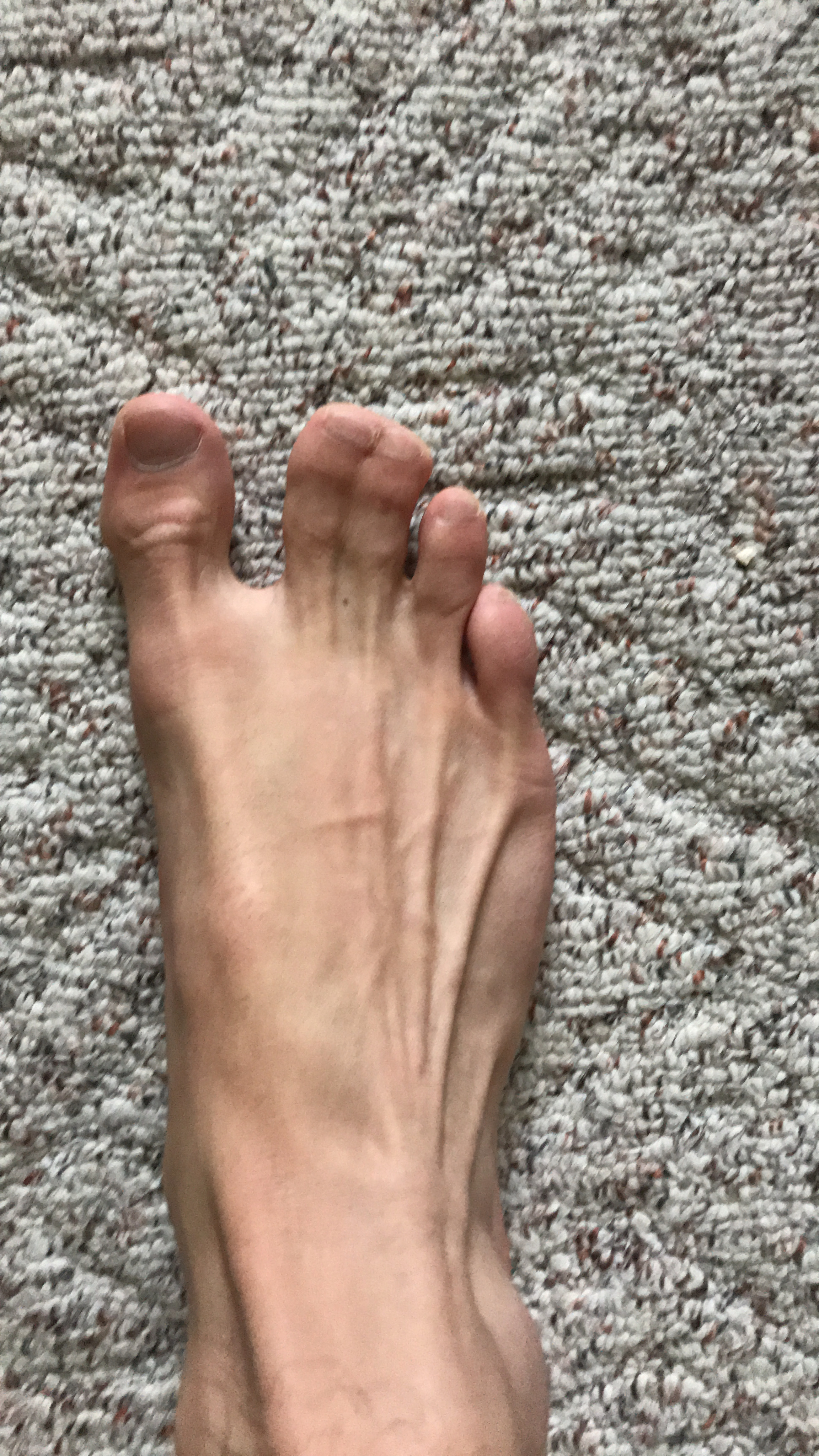 Webbed Toes profile