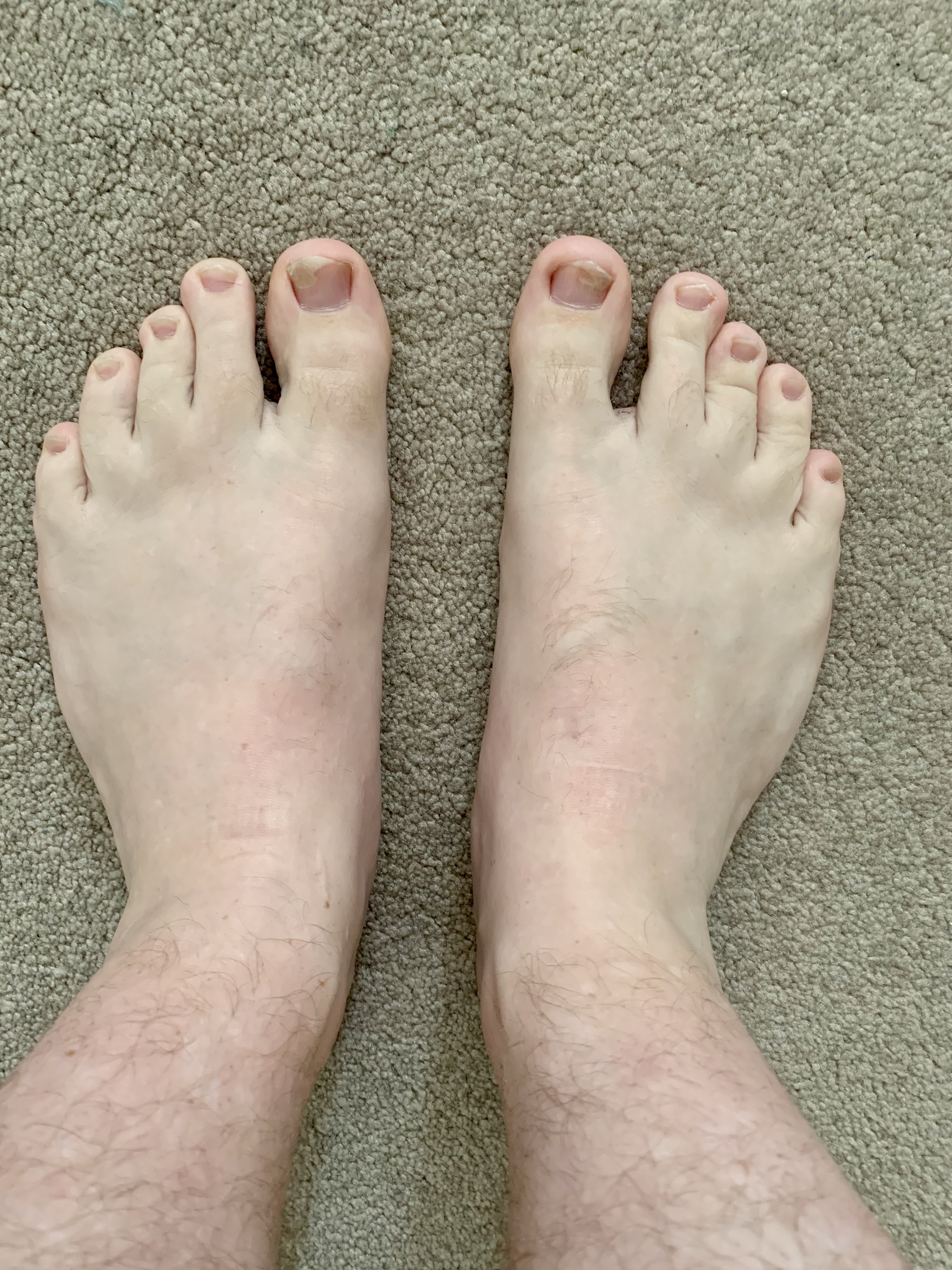 feetpics1219 thumbnail