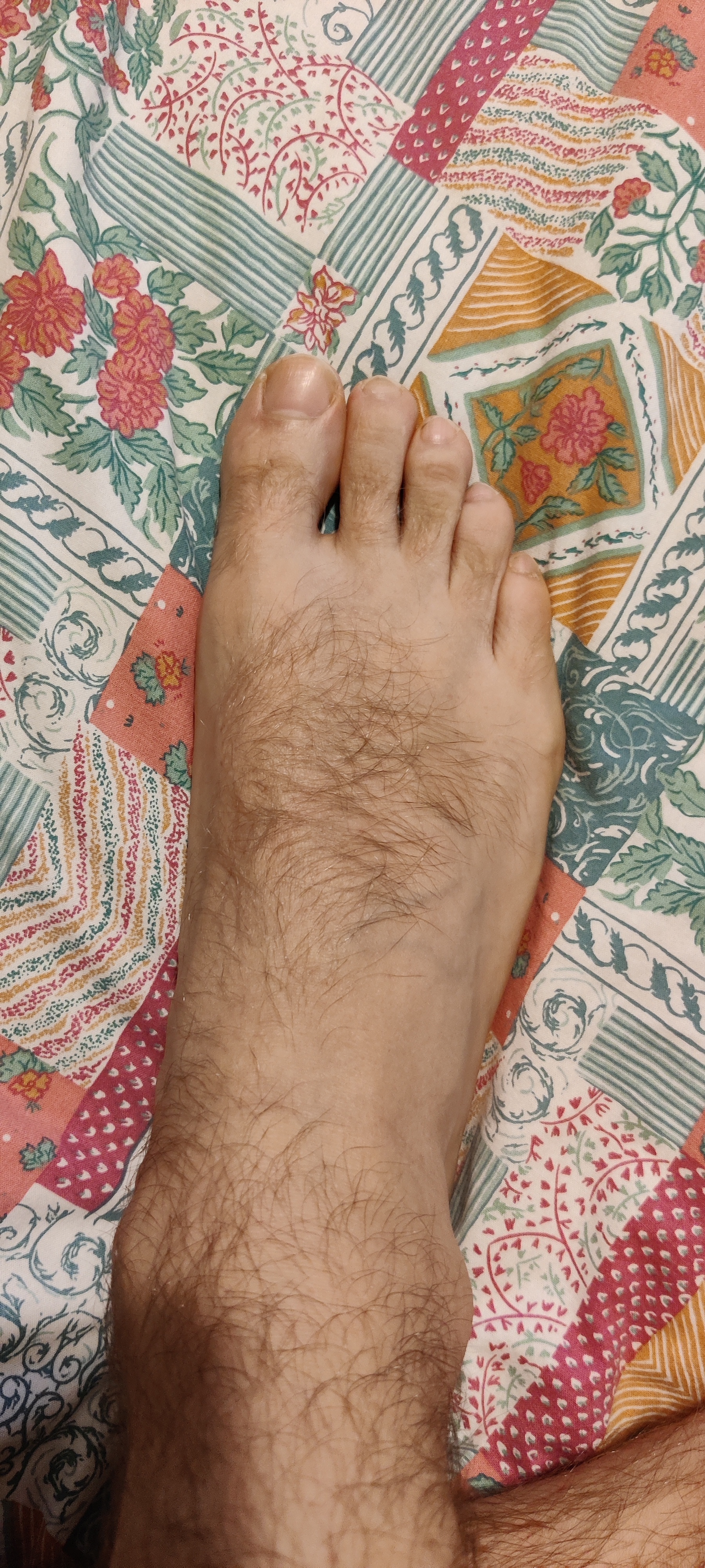 PP - Hairy Feet profile