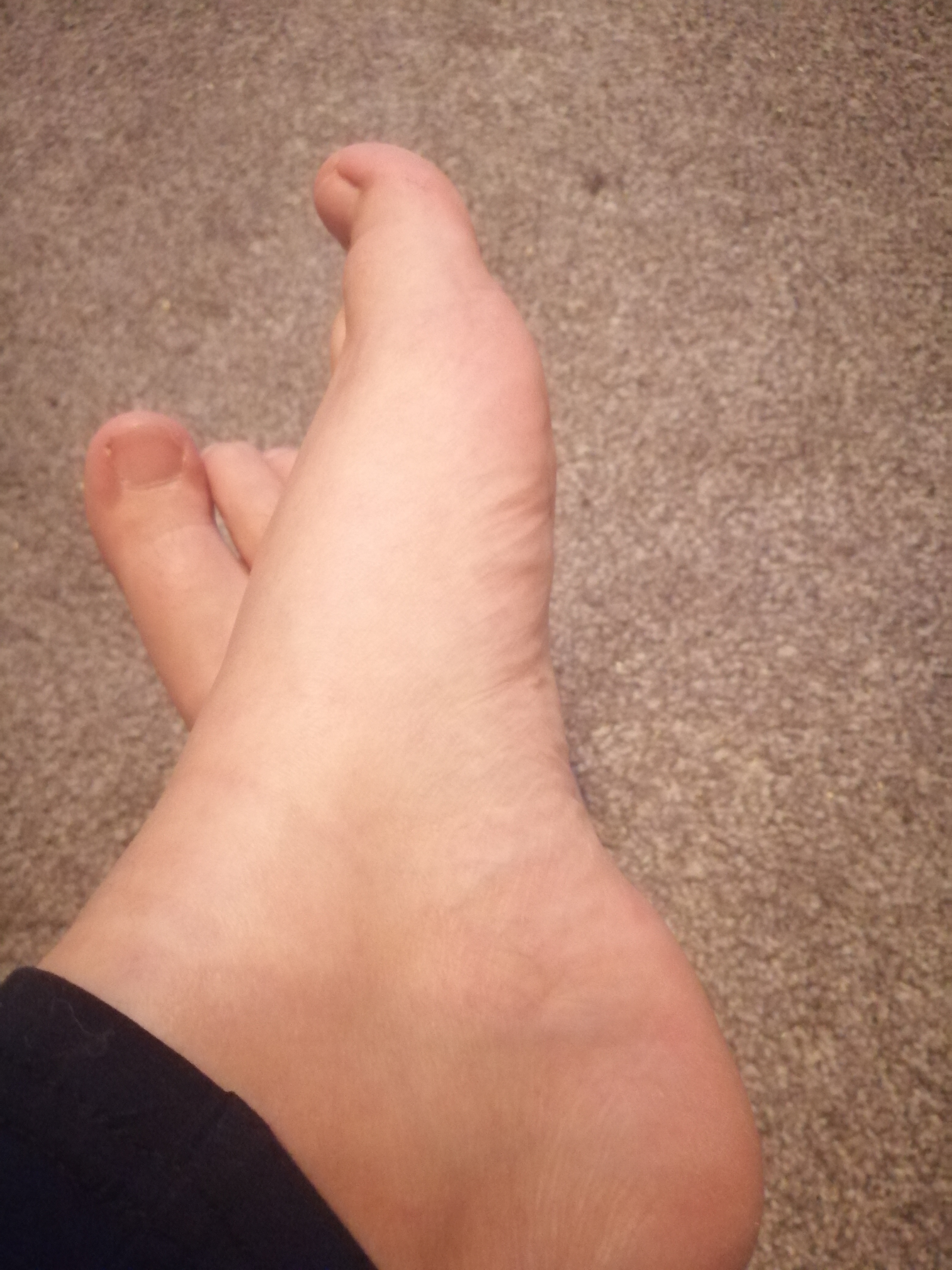 Mumfeet thumbnail