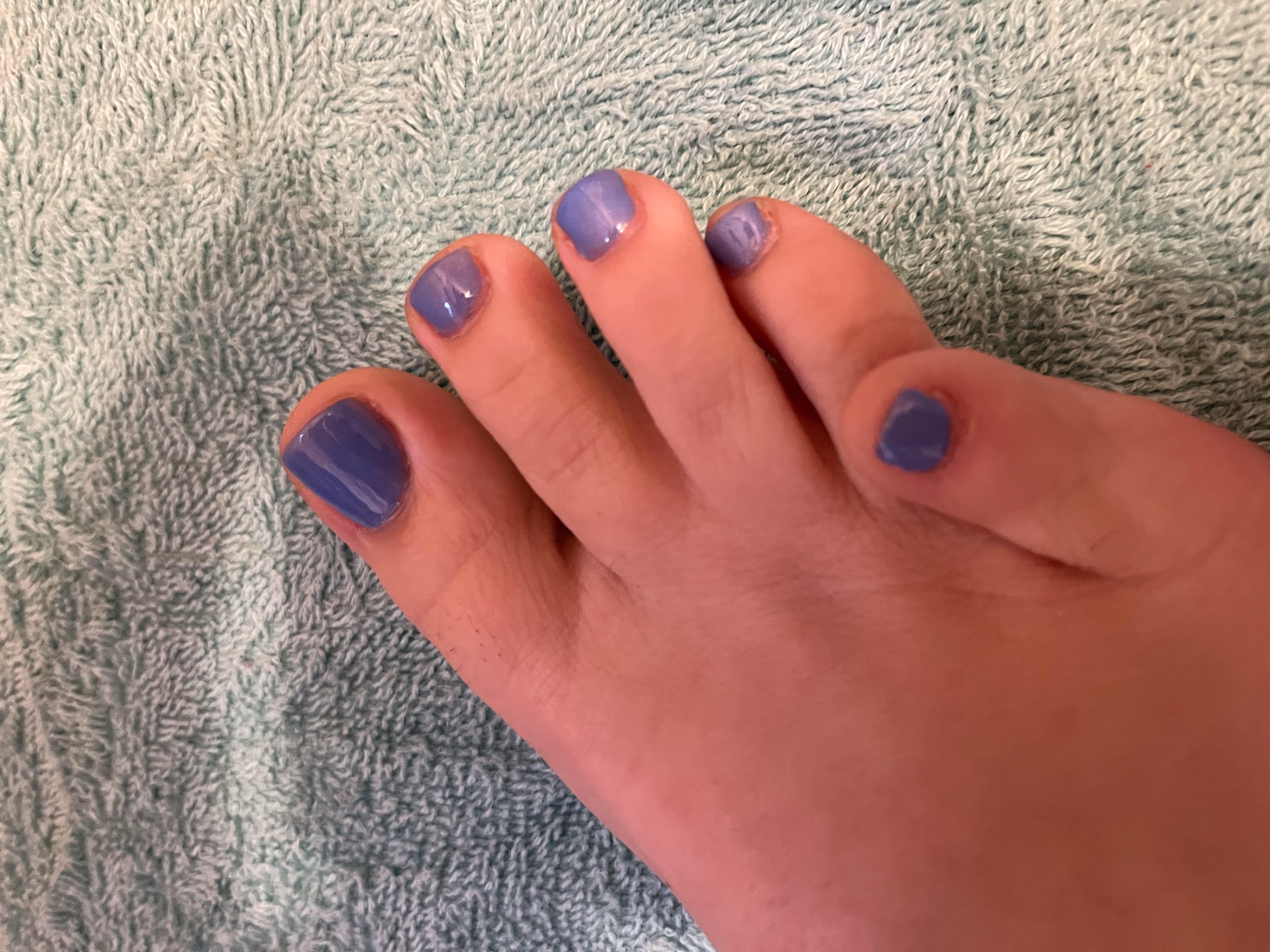 modeltoes8696 thumbnail