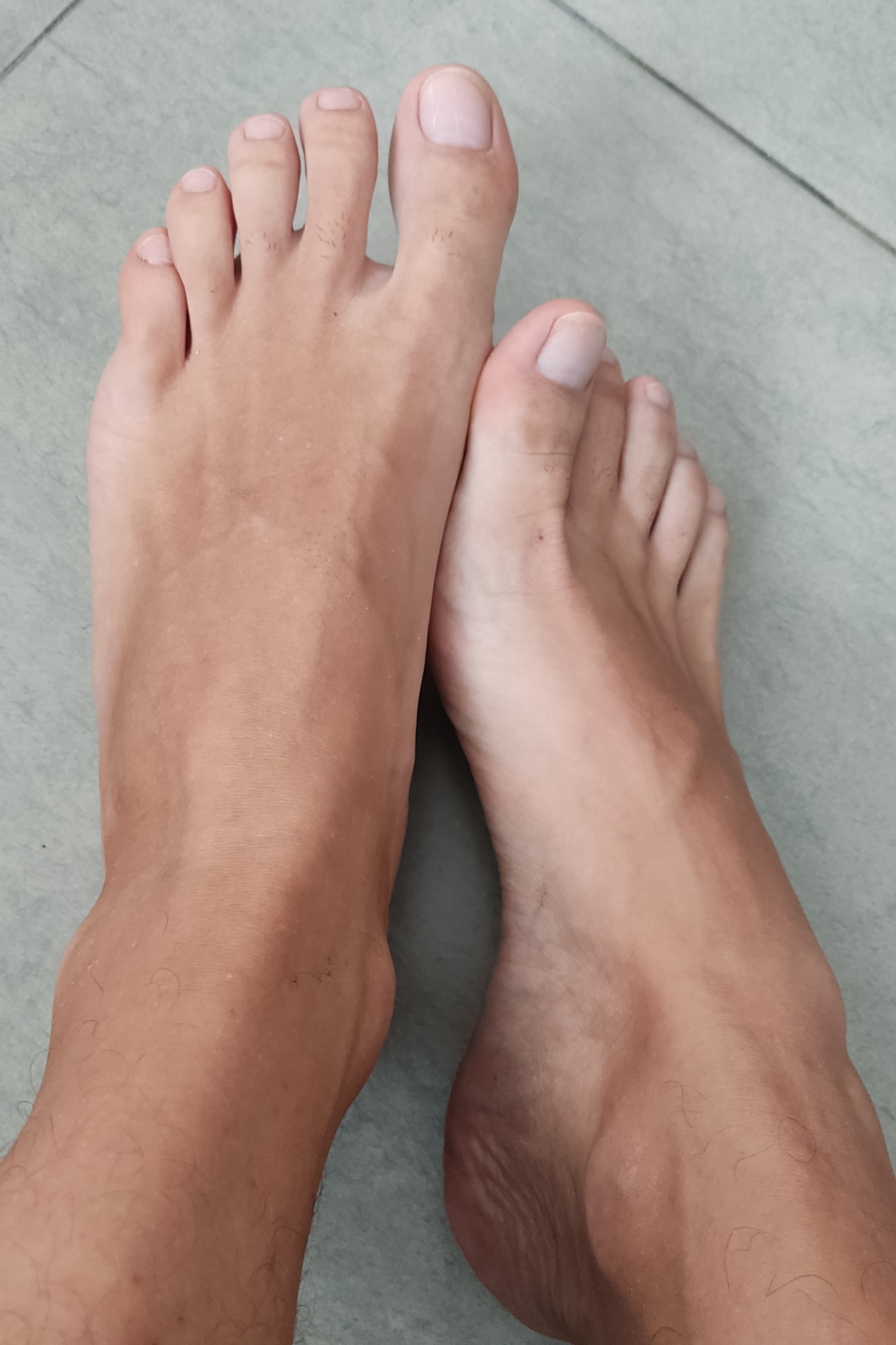 Feet profile