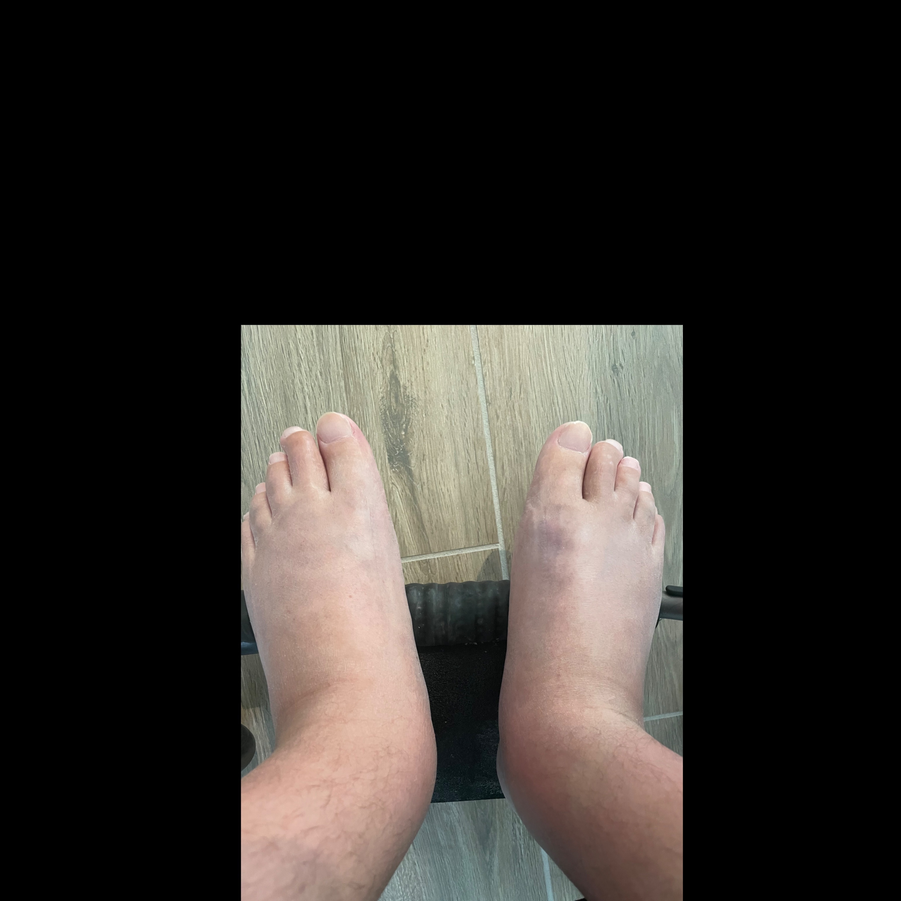 Parafeet thumbnail