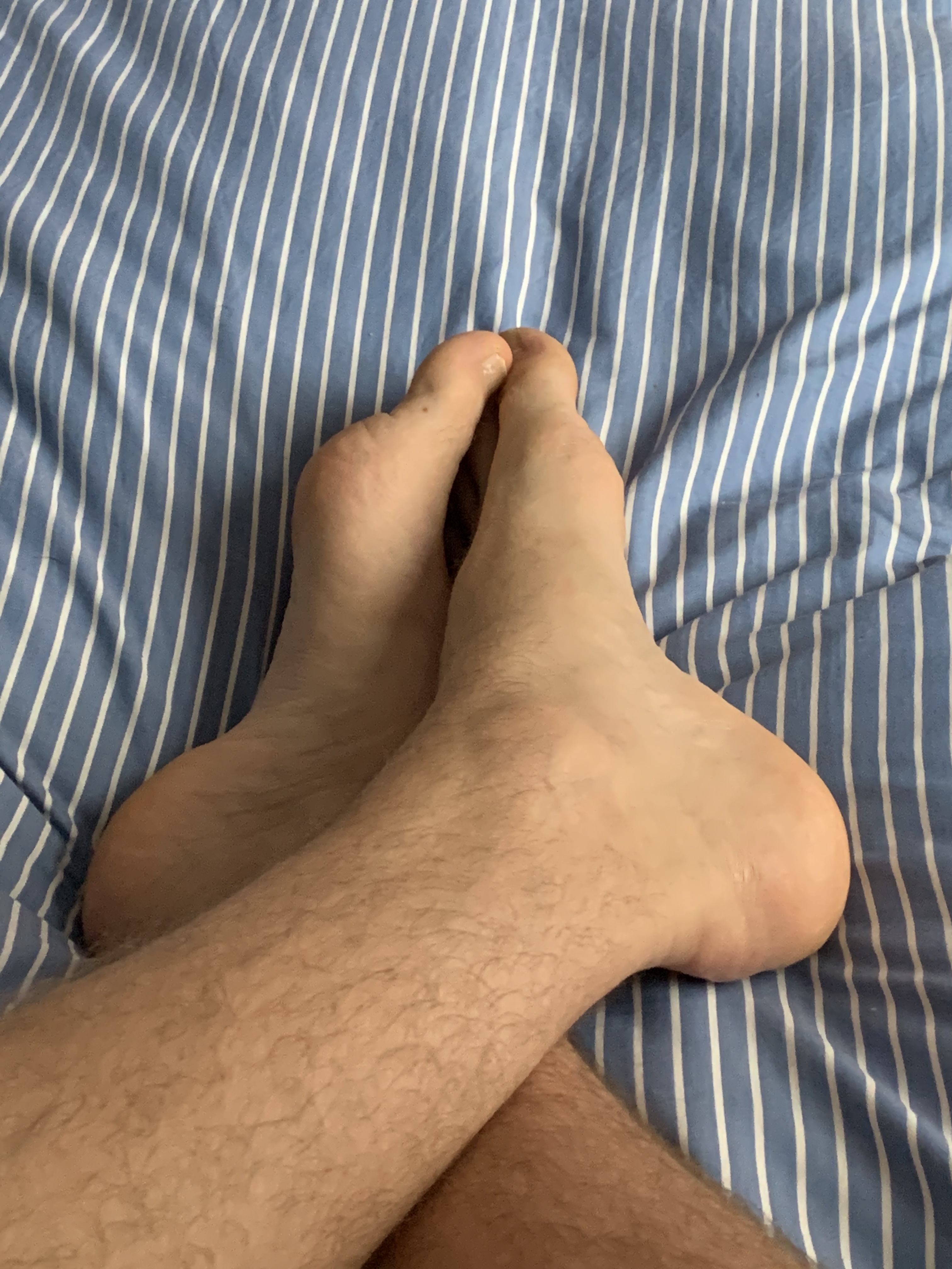 Brixtonymous Feet thumbnail