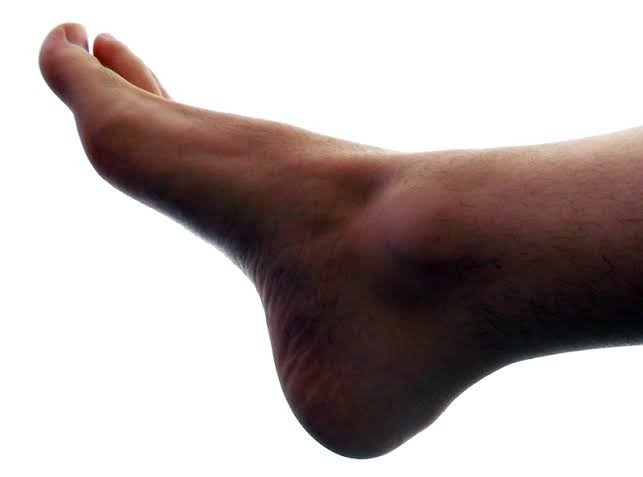 foot_br thumbnail