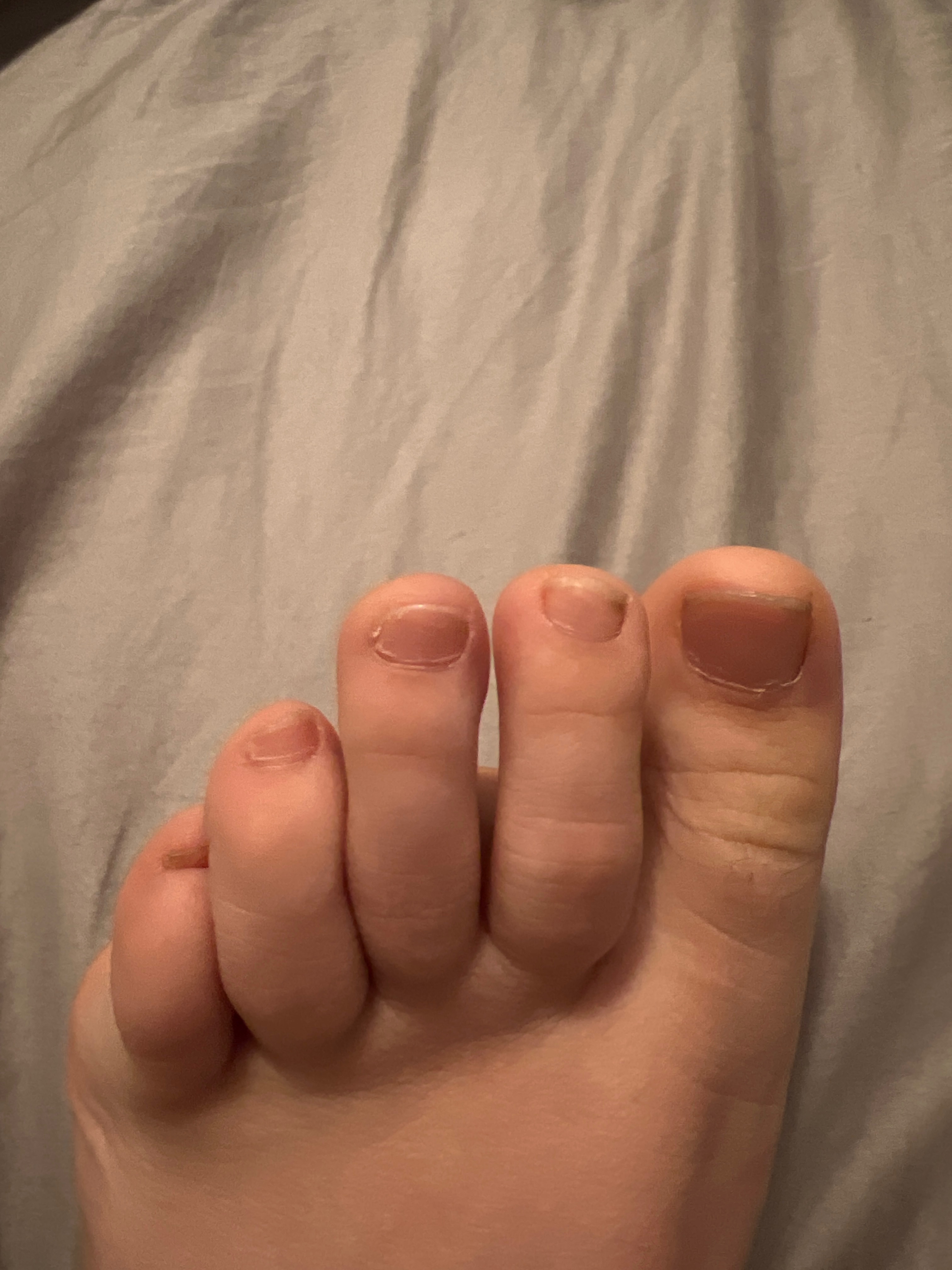 feetandhand00cover