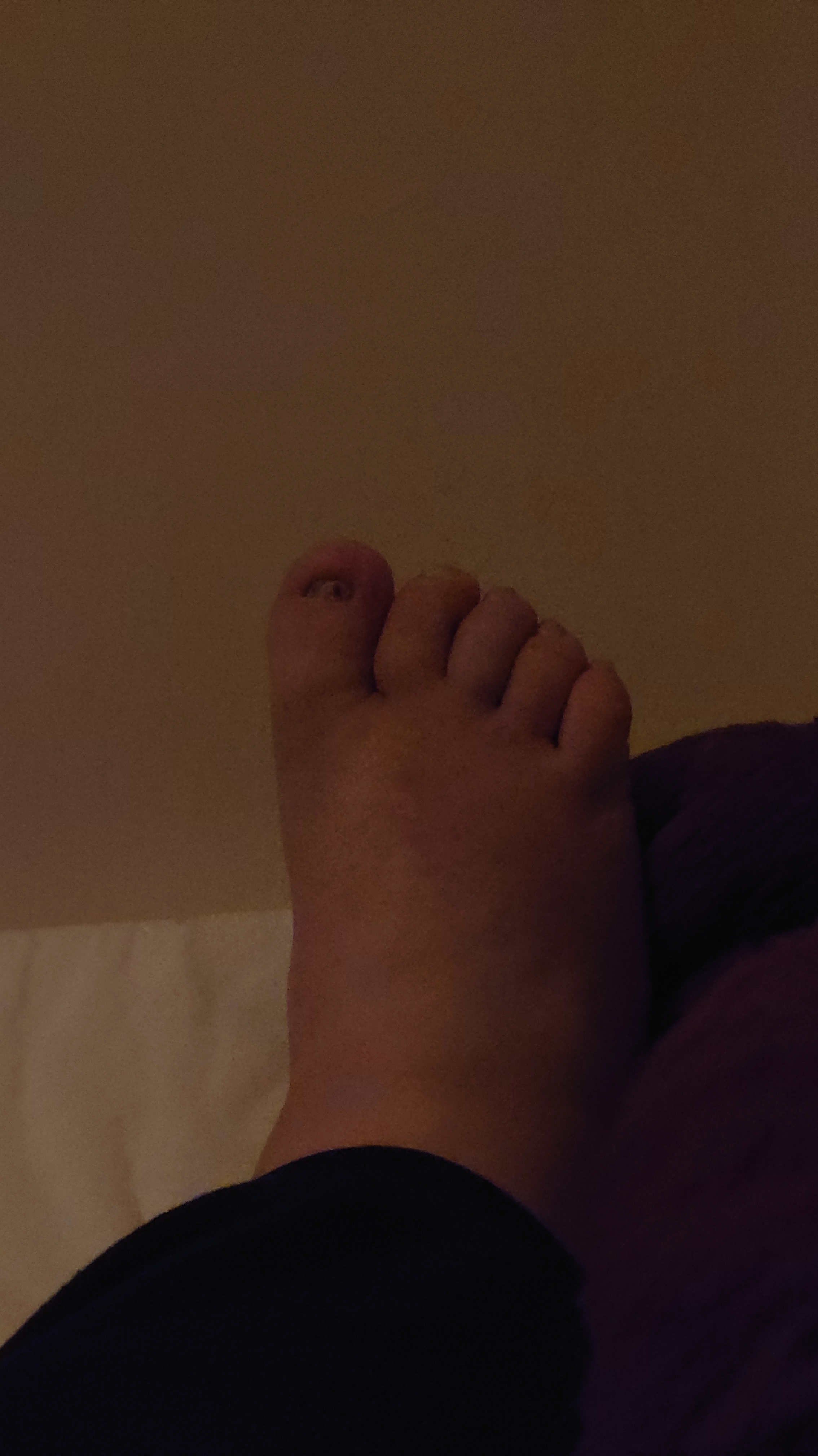 Fat feet. thumbnail