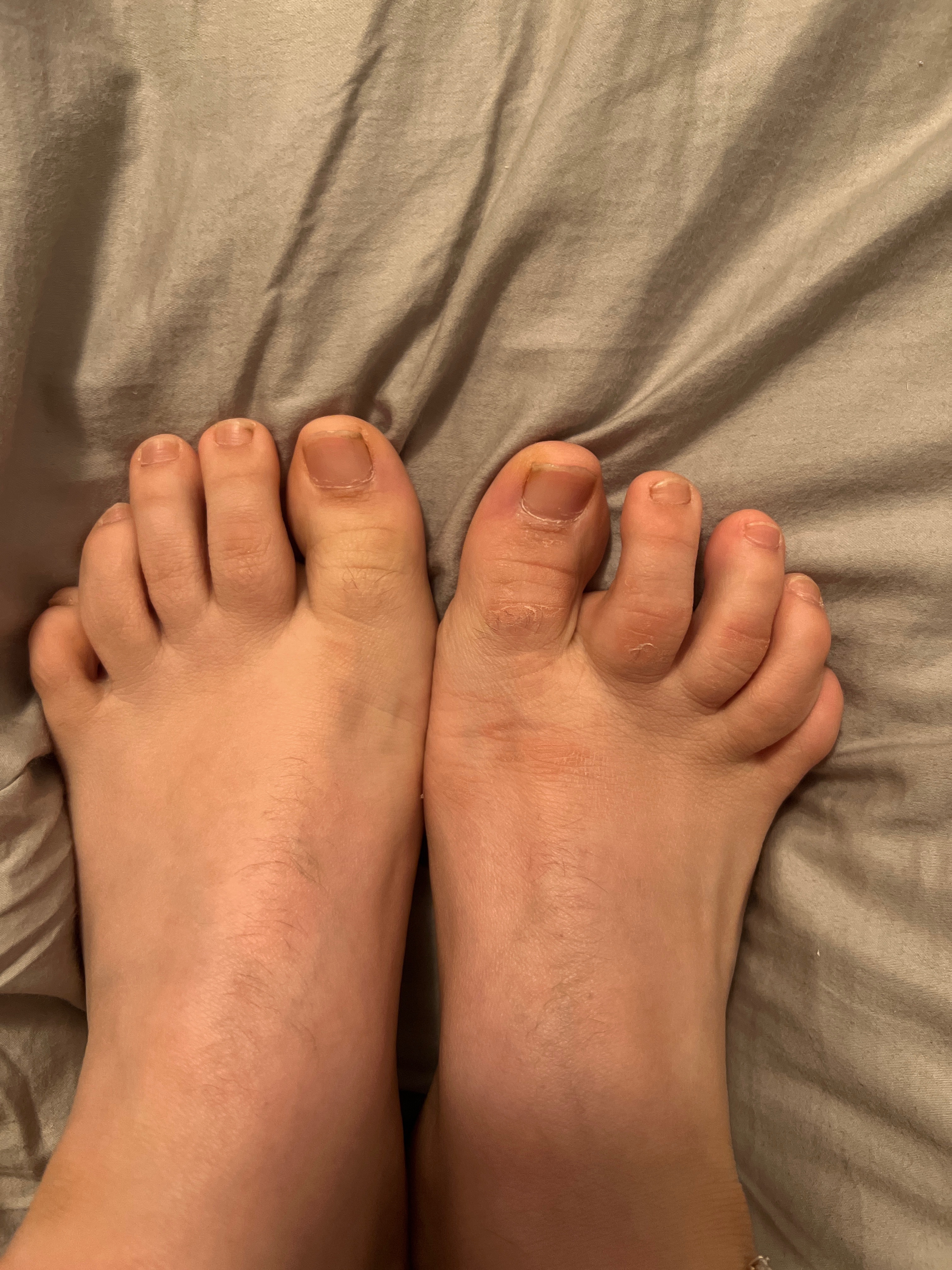 Juicyfeet thumbnail