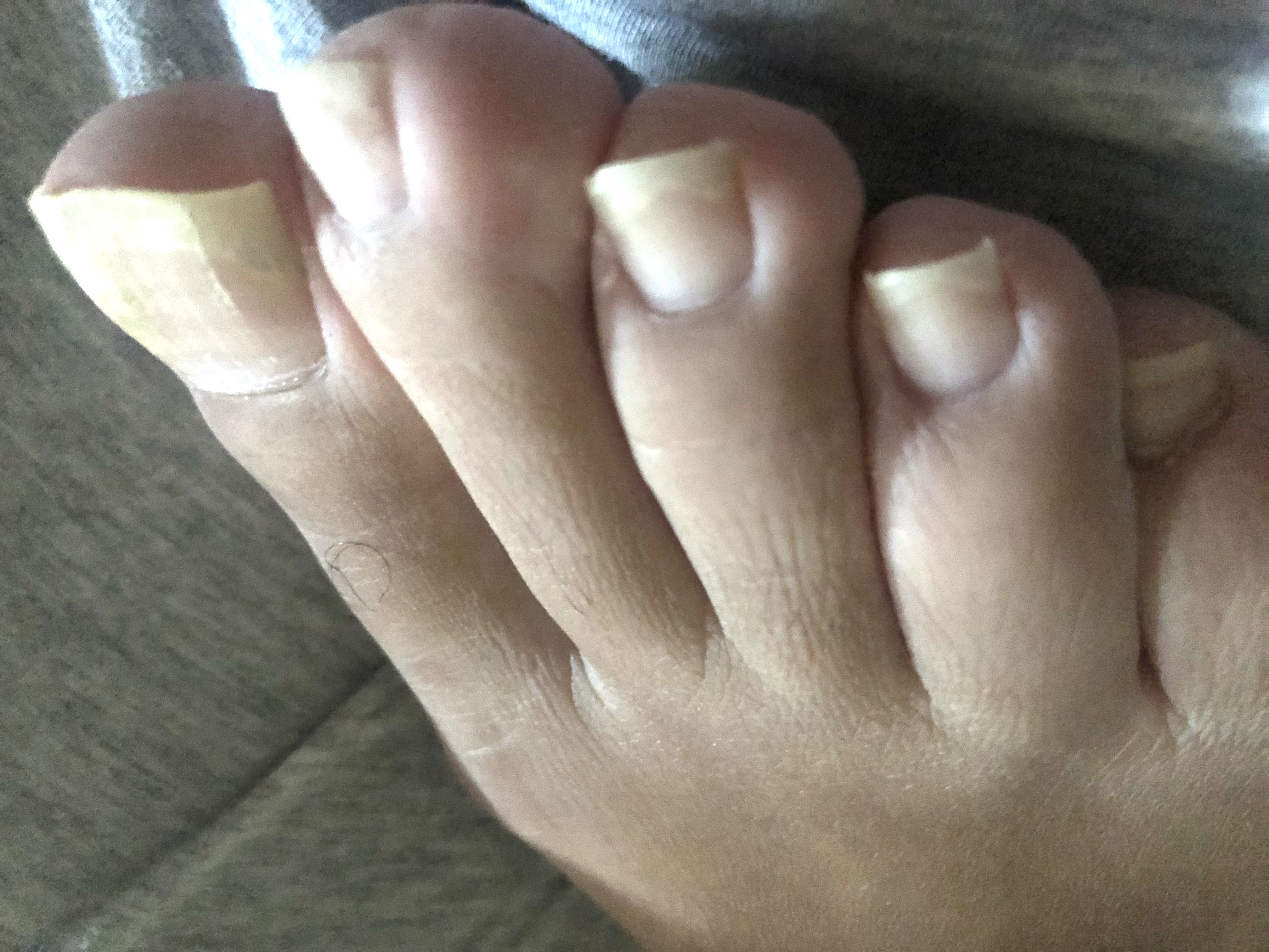 Toes thumbnail