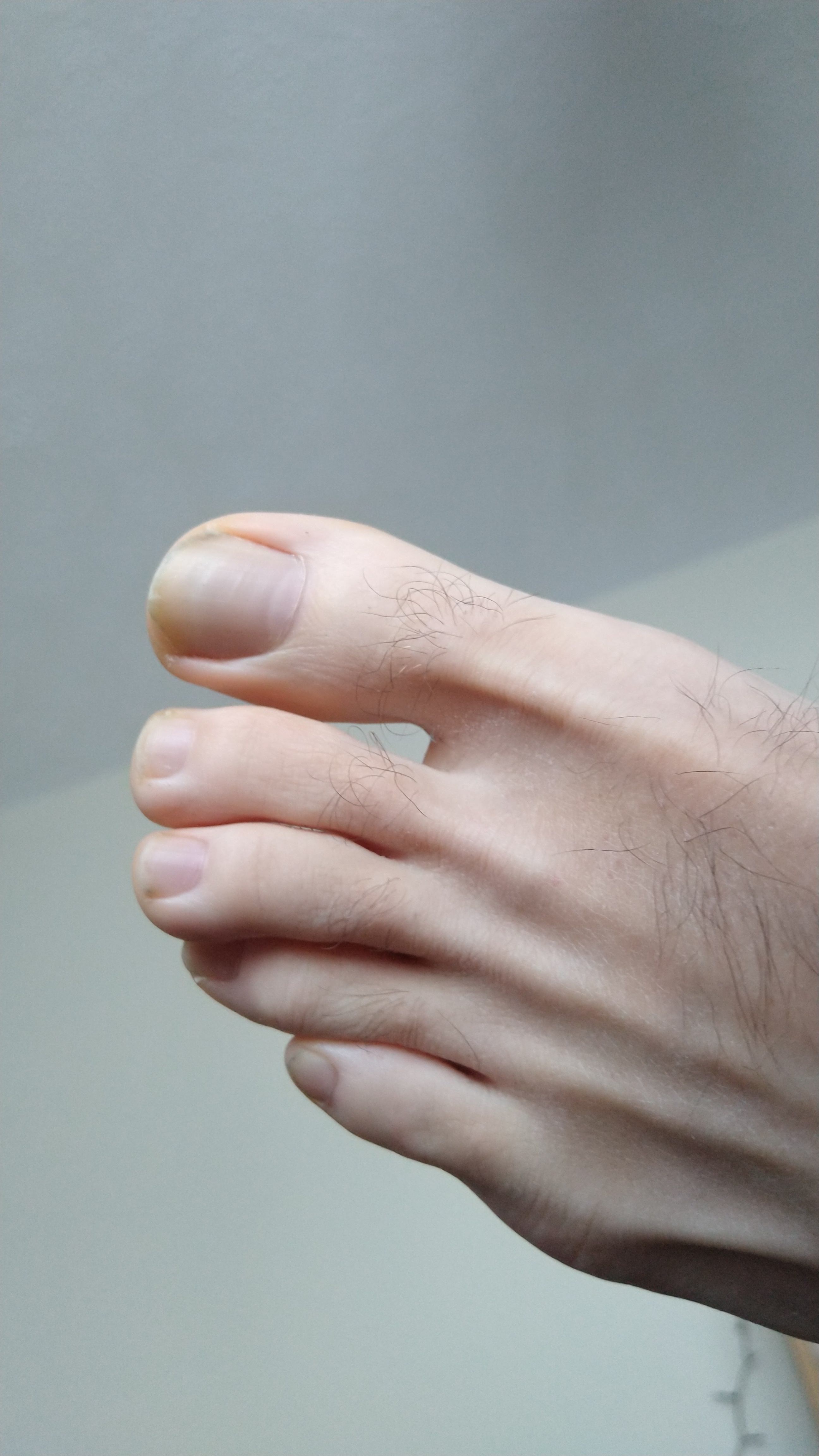 feetmehalfway profile