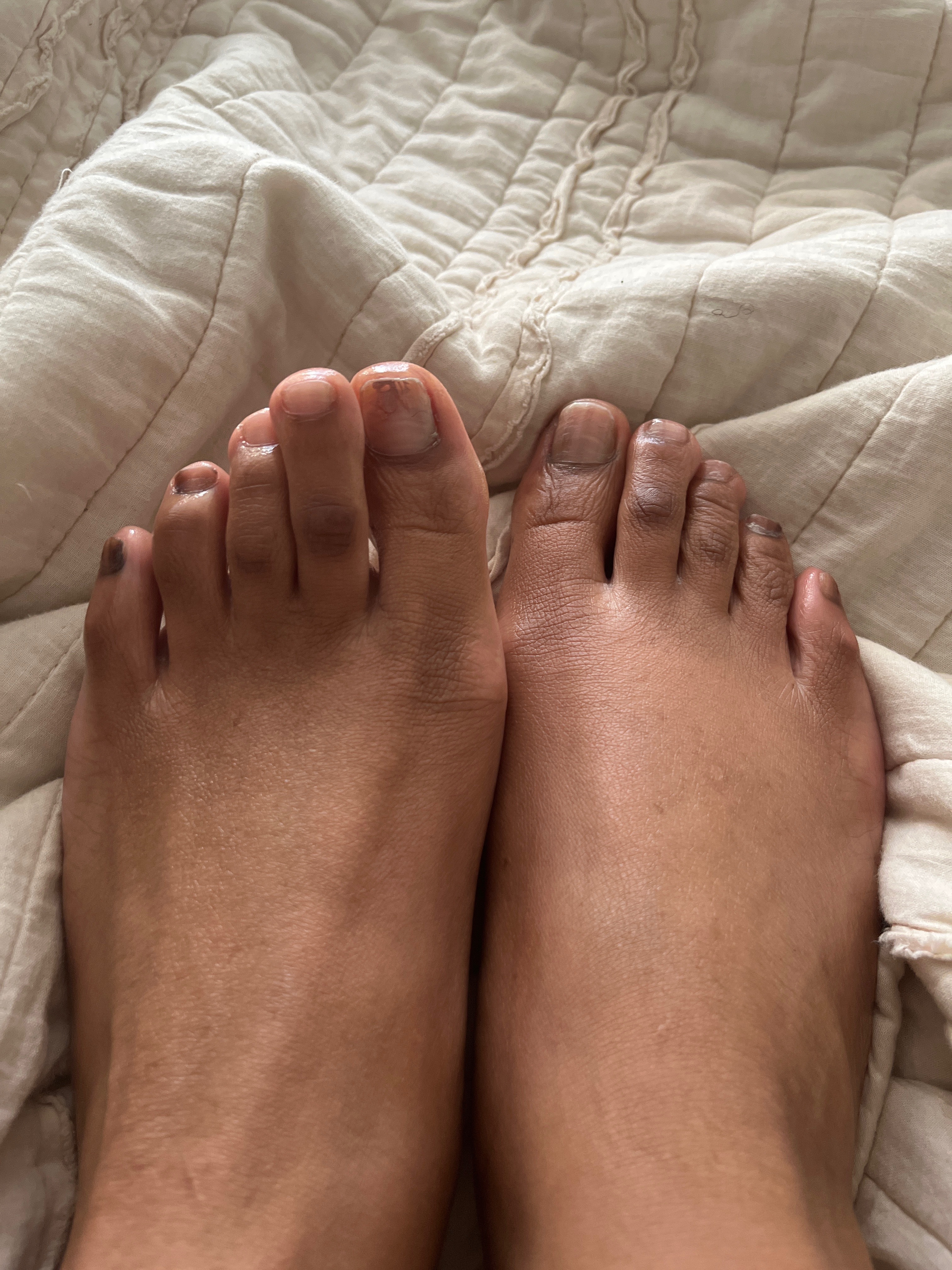 A Real Girl’s Toes profile