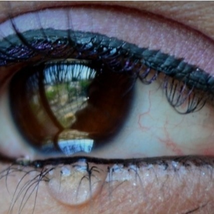 Watery-Eyes thumbnail