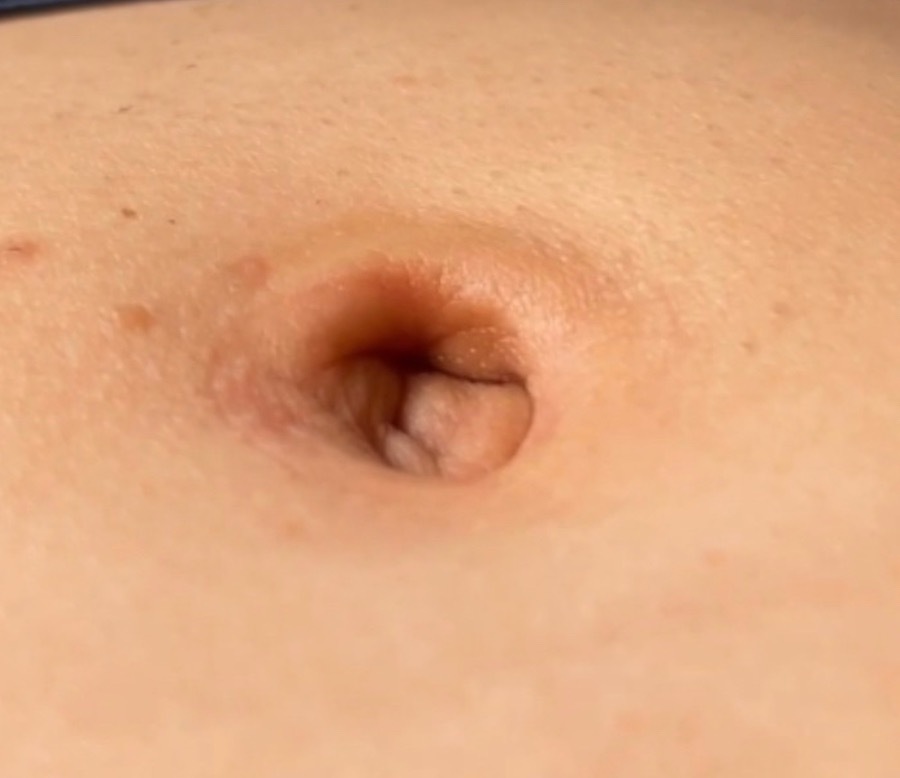 XNavel profile