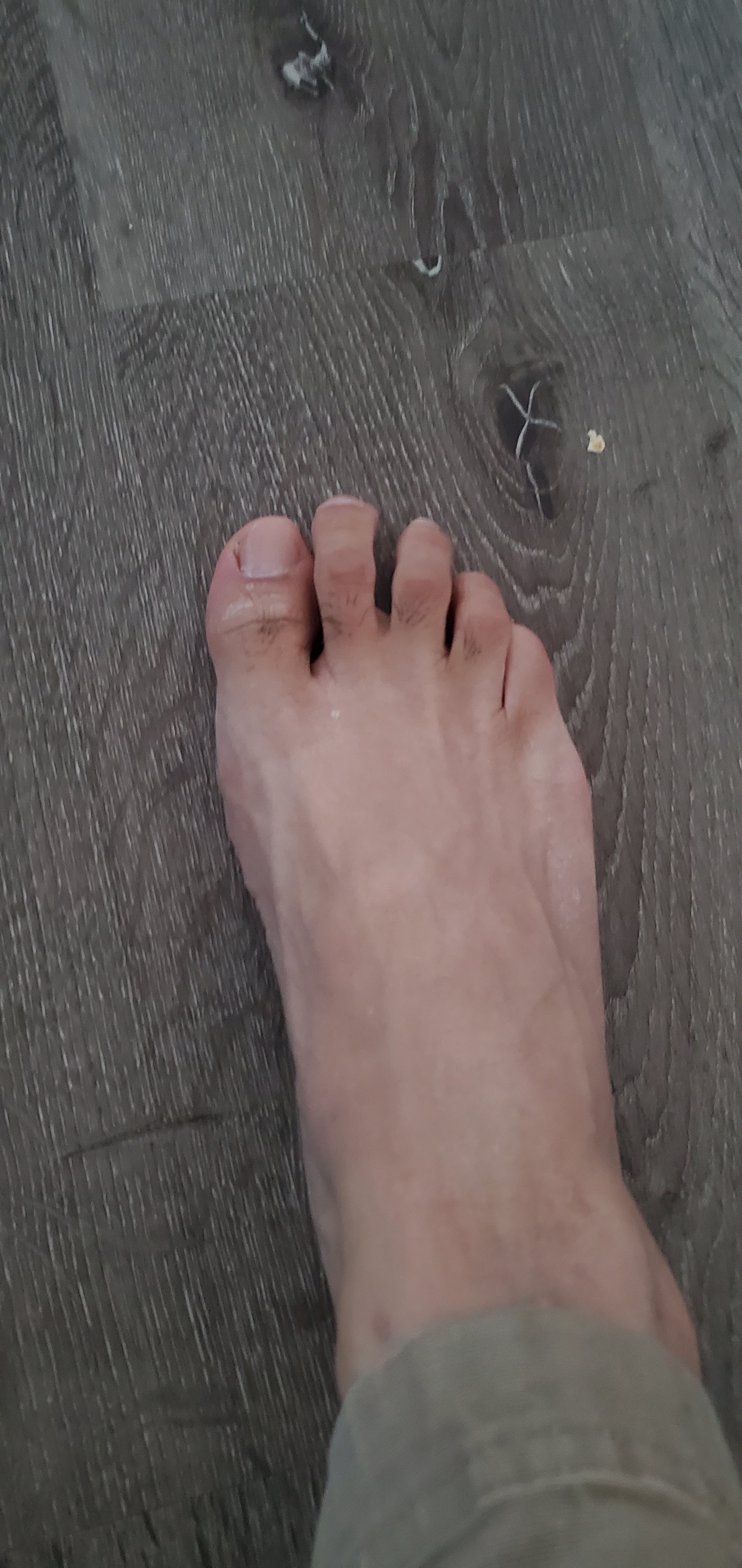 biglongtoe thumbnail