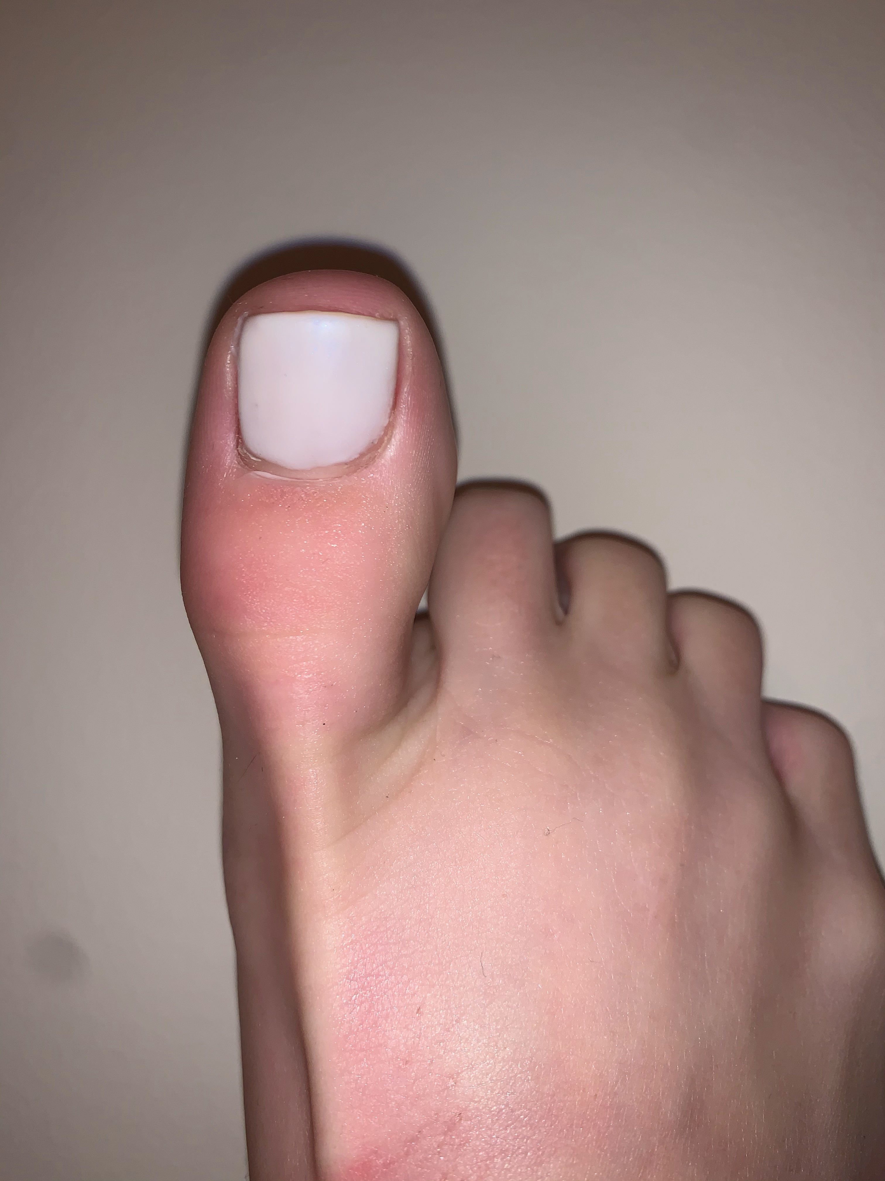 The Official Toe Hoe profile