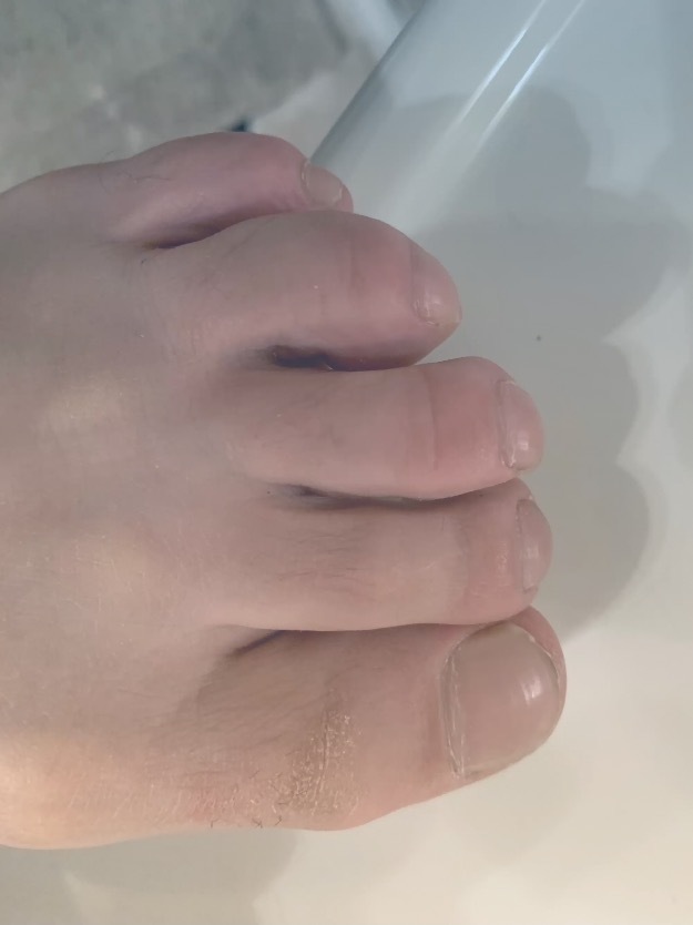 My Thick Toes profile