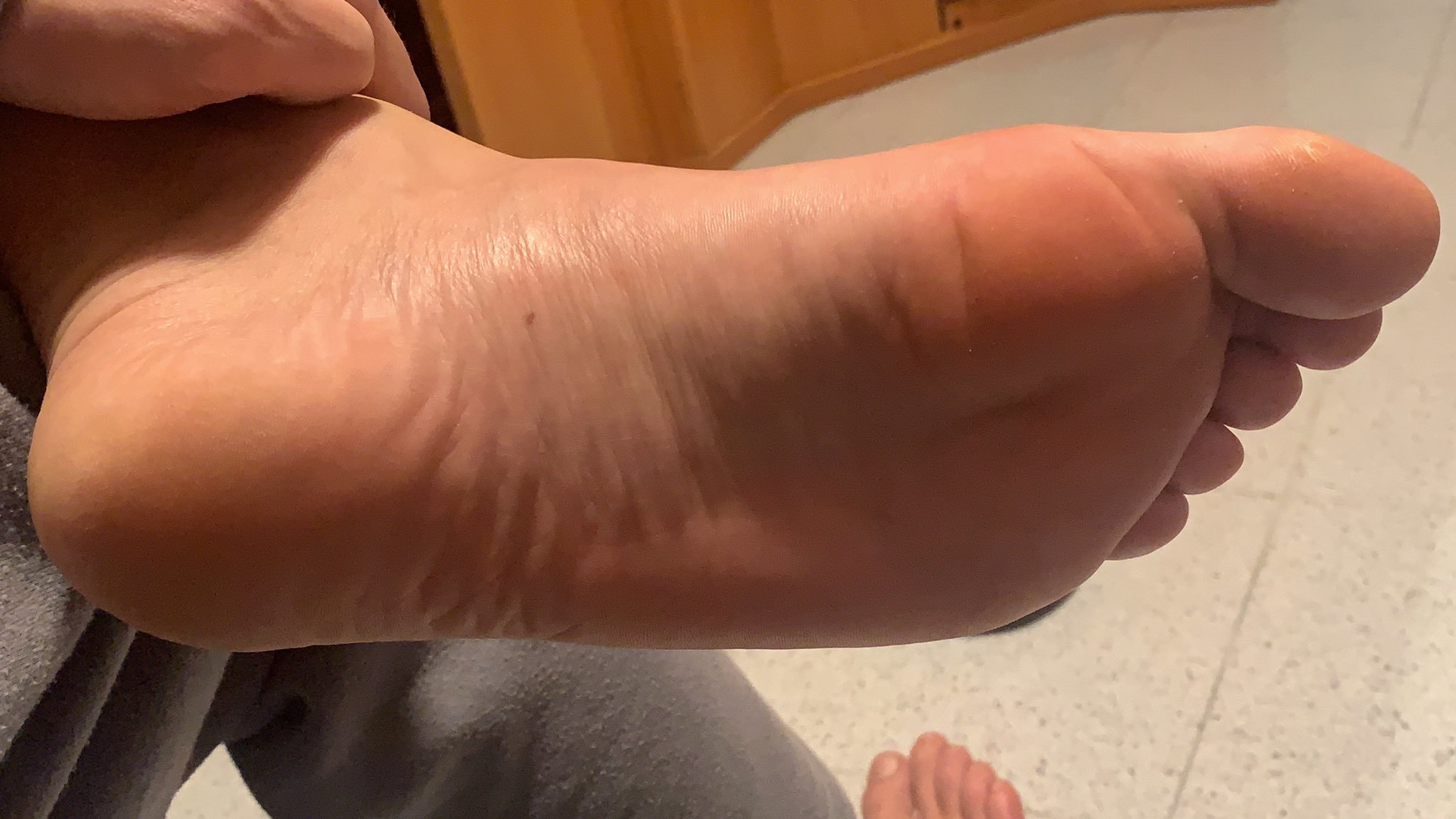 nacofeet thumbnail