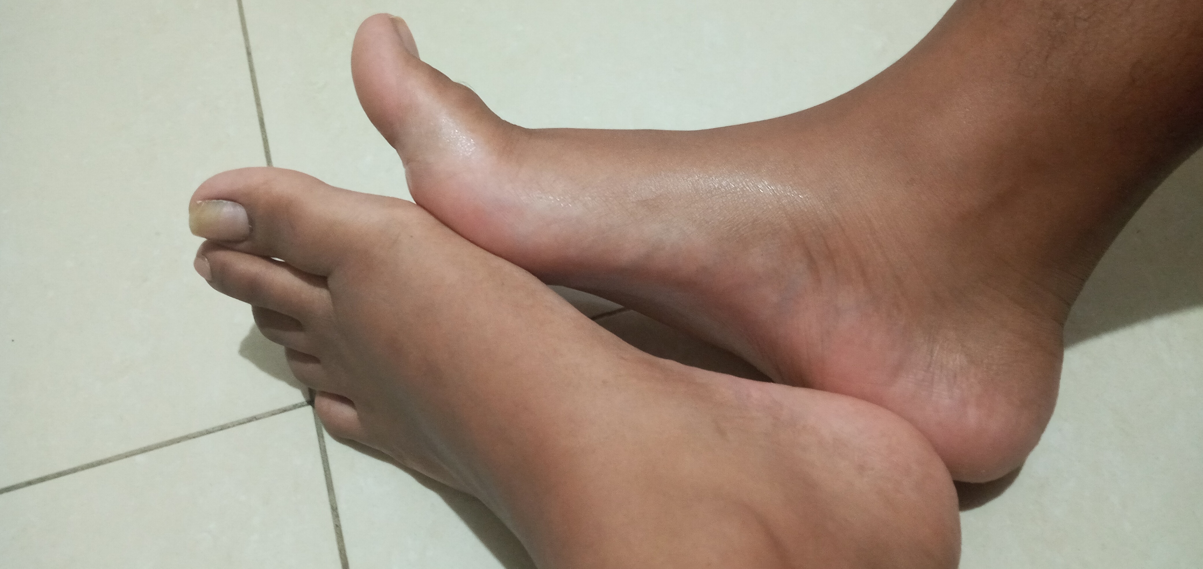 feetwithnil thumbnail