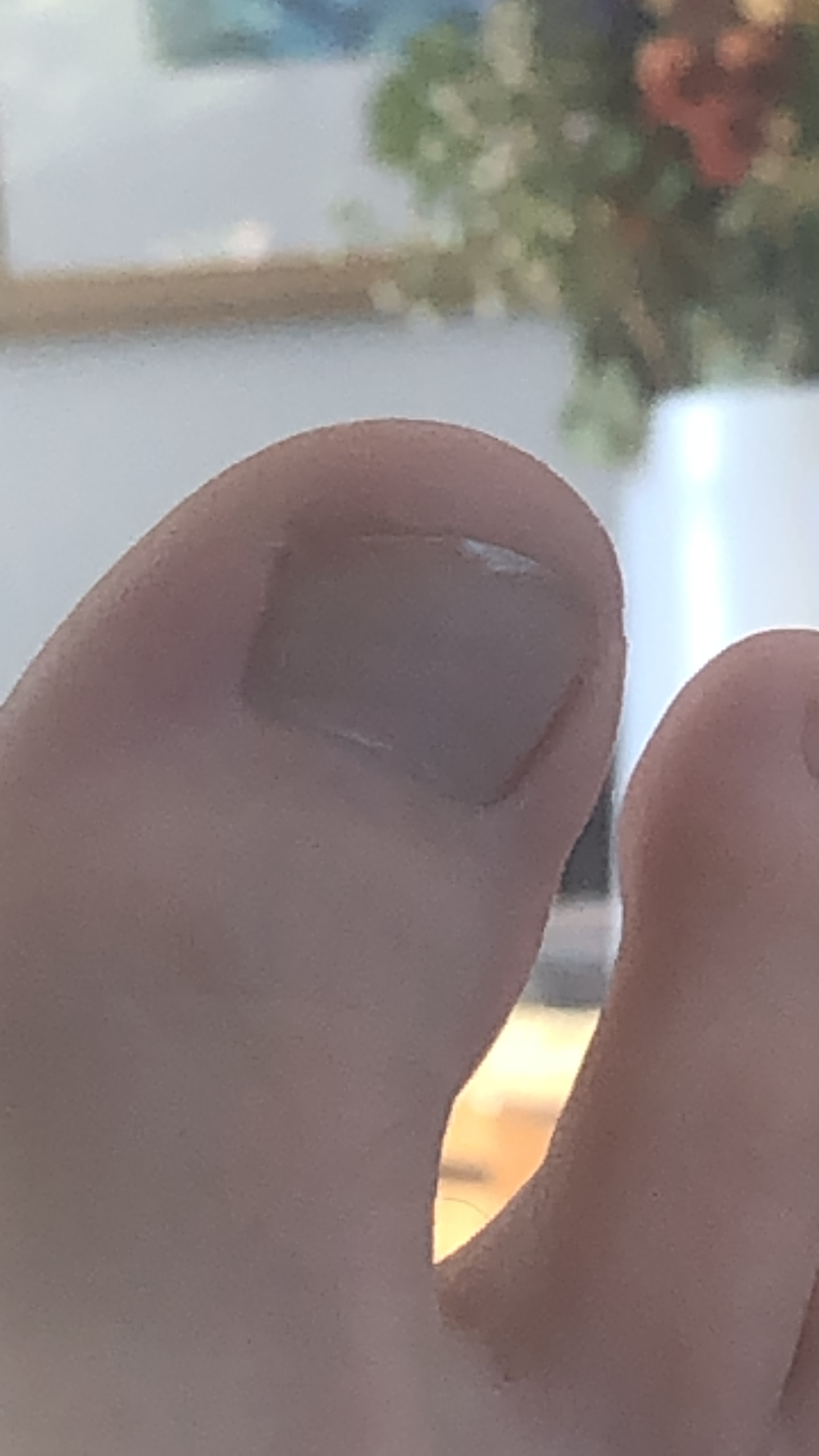 noncytoes profile