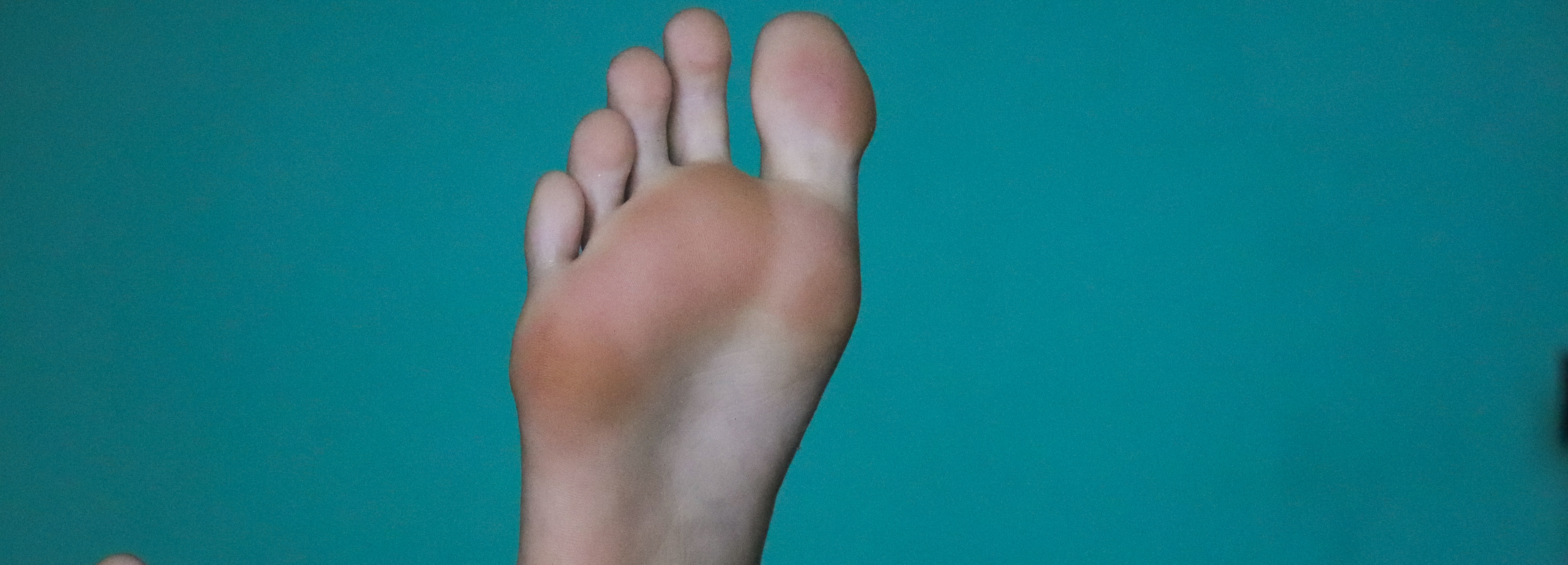 feetbecks thumbnail