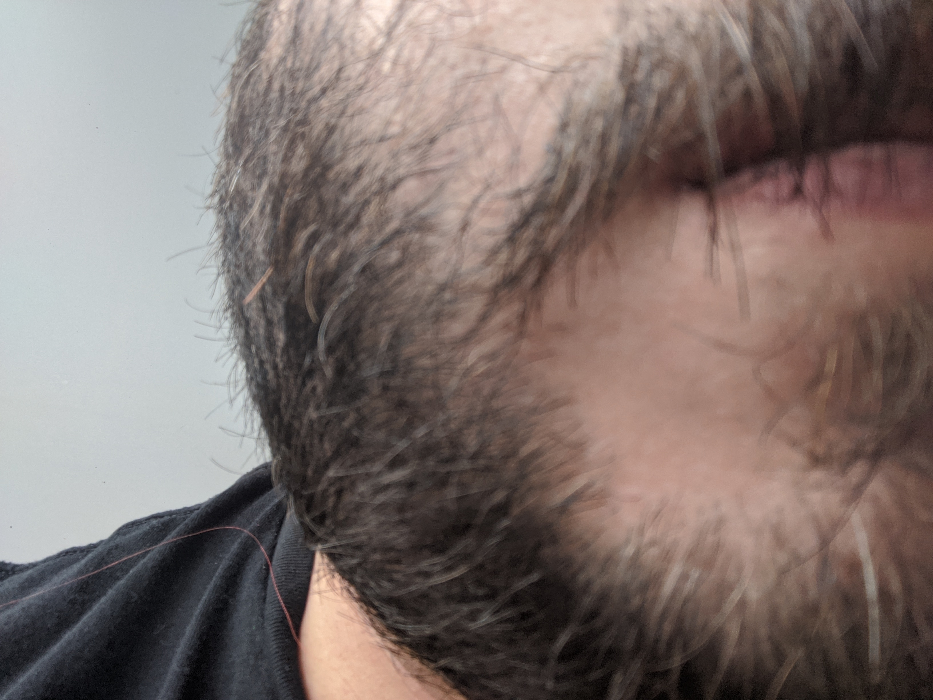 beard thumbnail