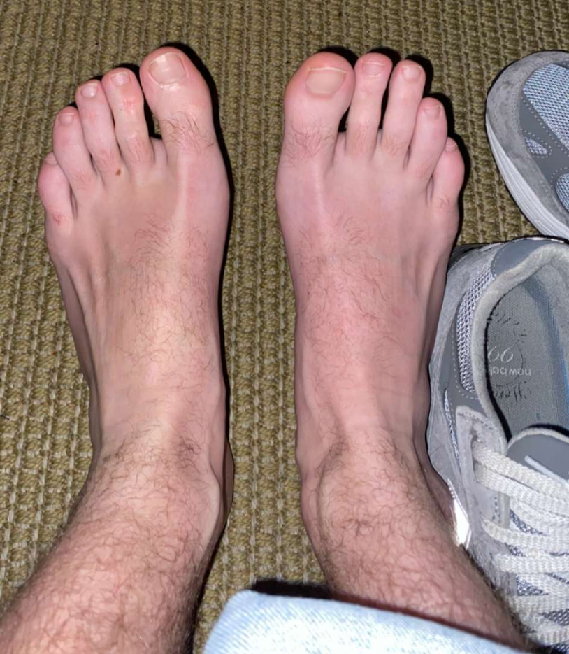 Freshman Feet profile