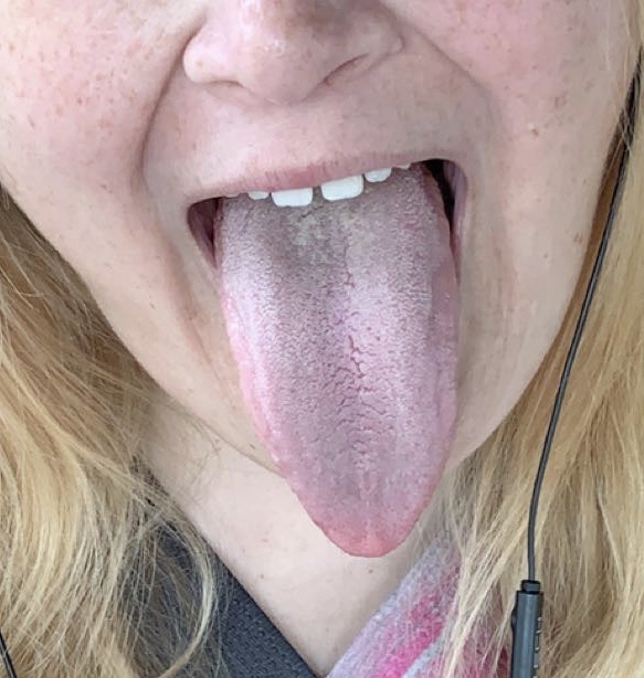 tonguethroatlove profile