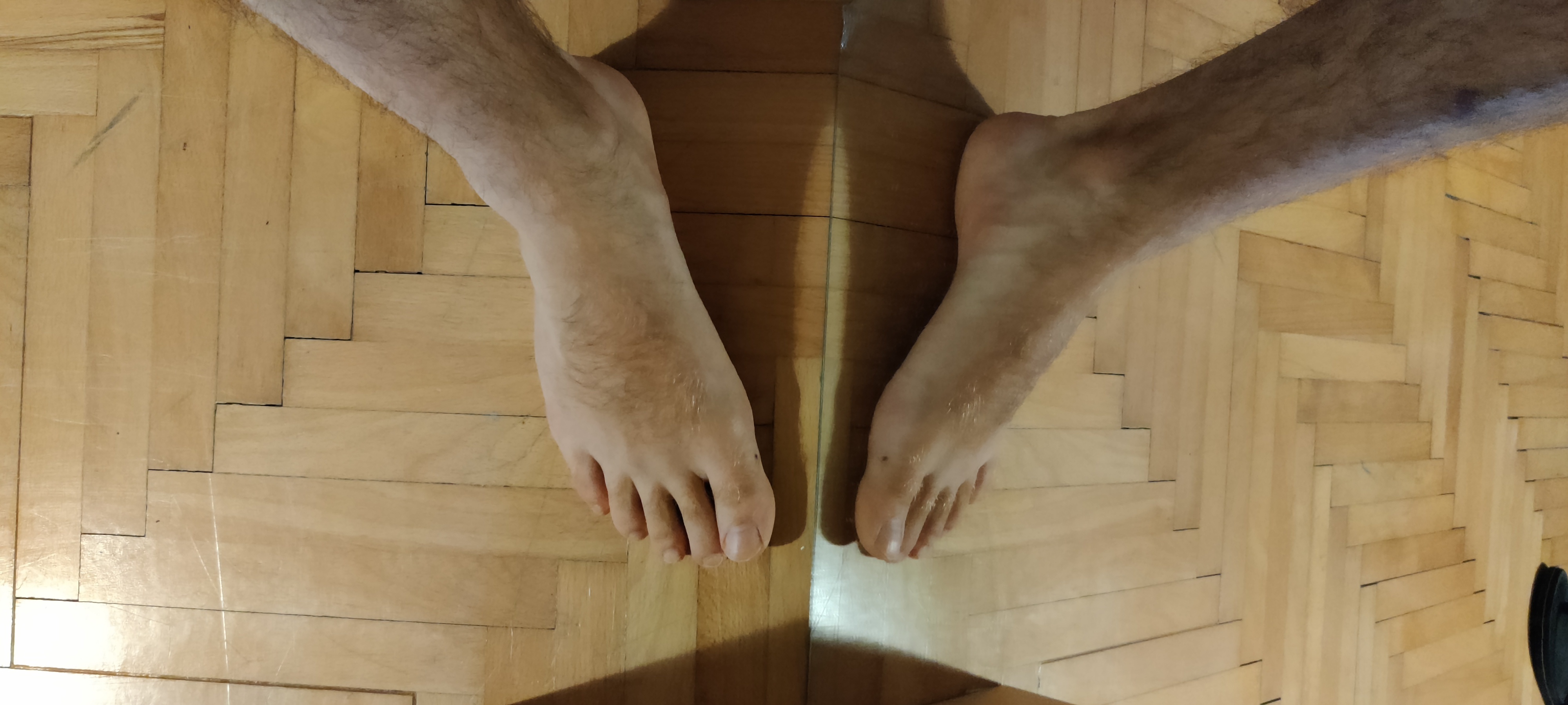 PP - Hairy Feet thumbnail