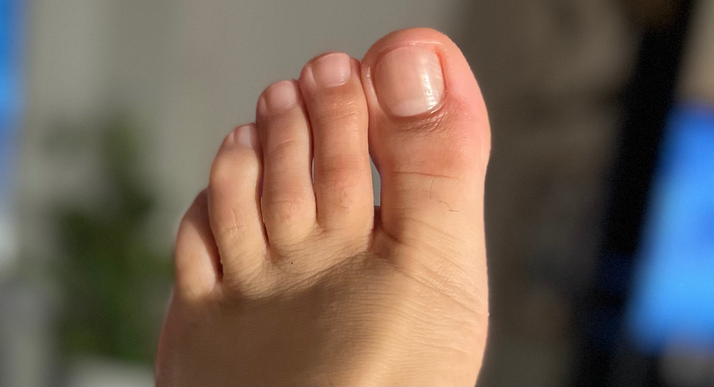 Melbfeet thumbnail