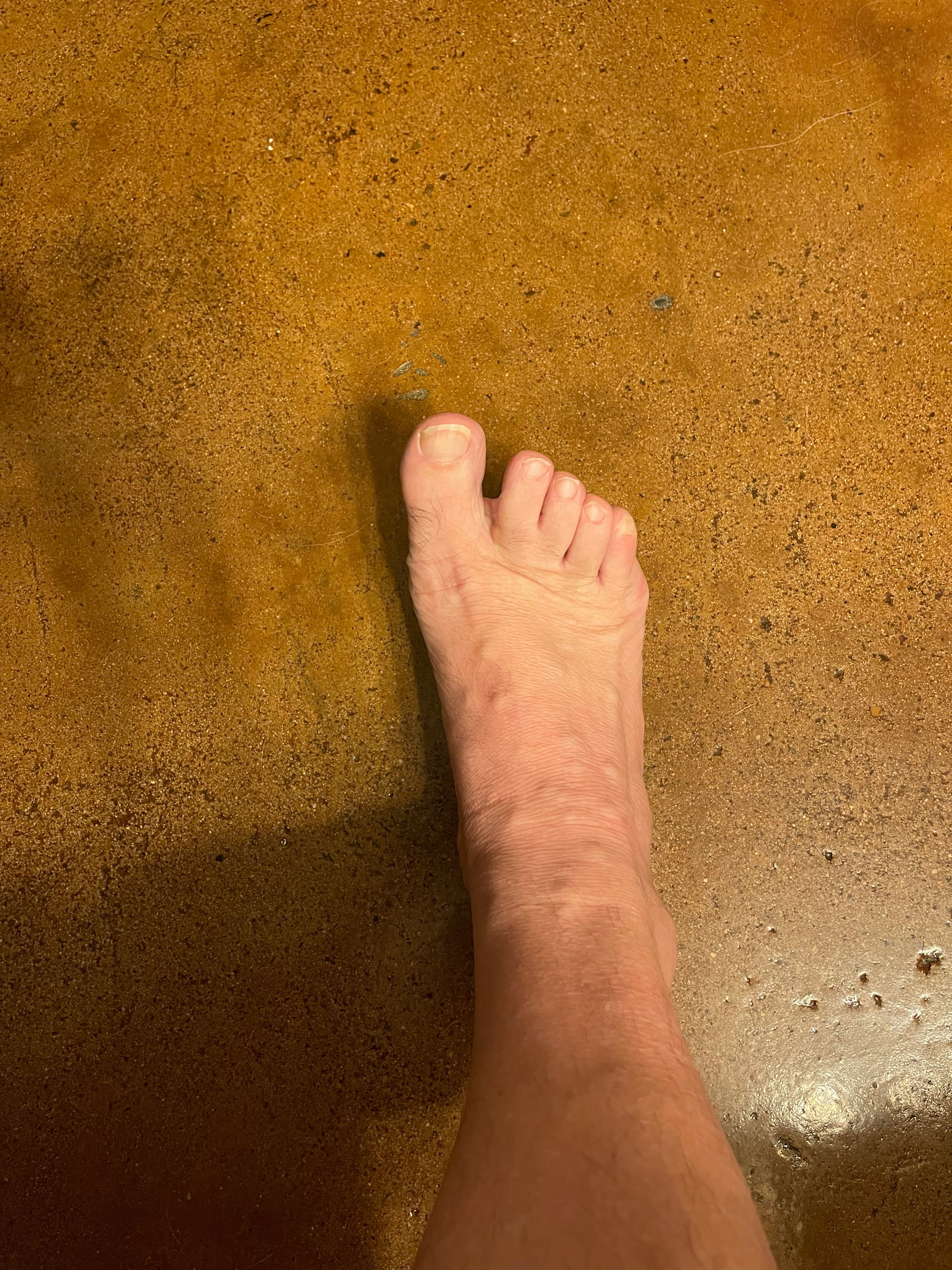 texasfeetwebbedtoe profile