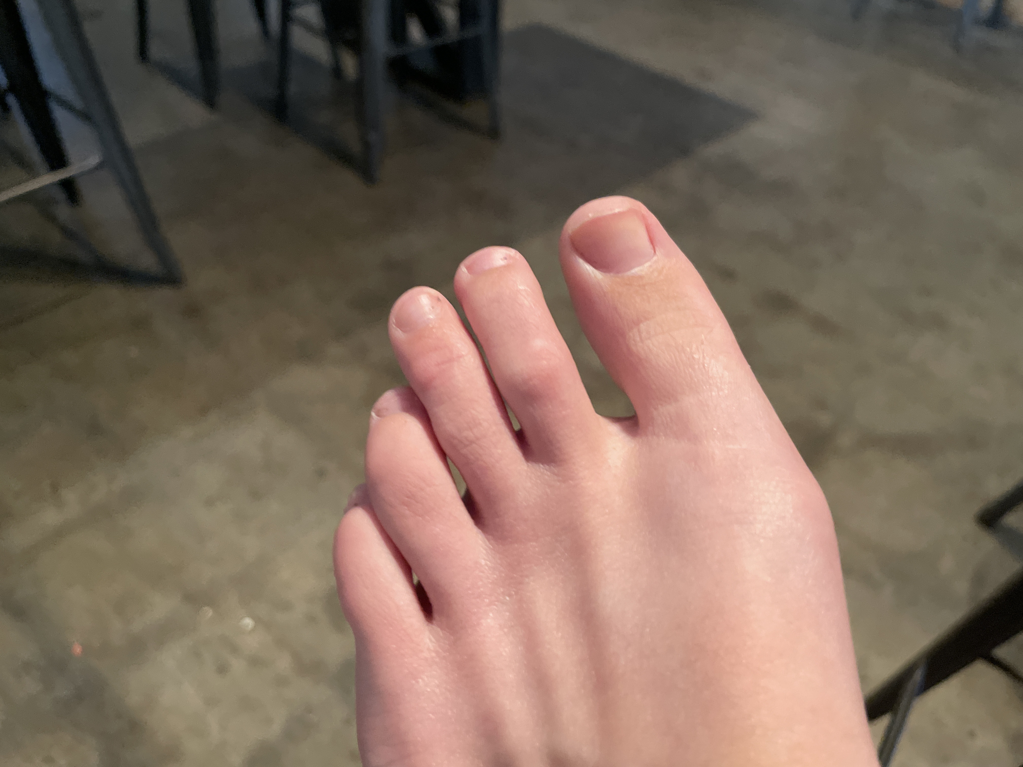 KC Toe profile