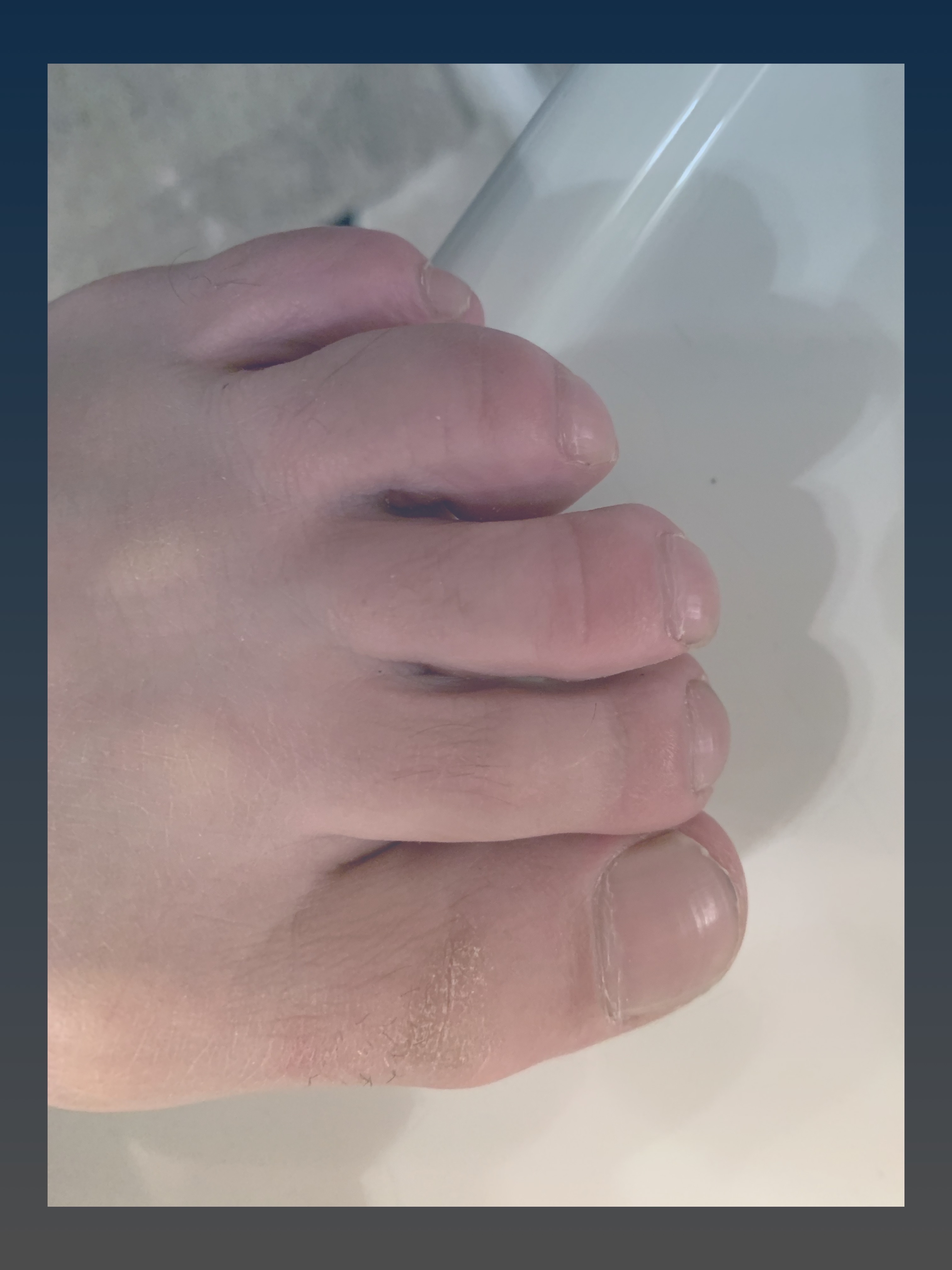 mythicktoes thumbnail