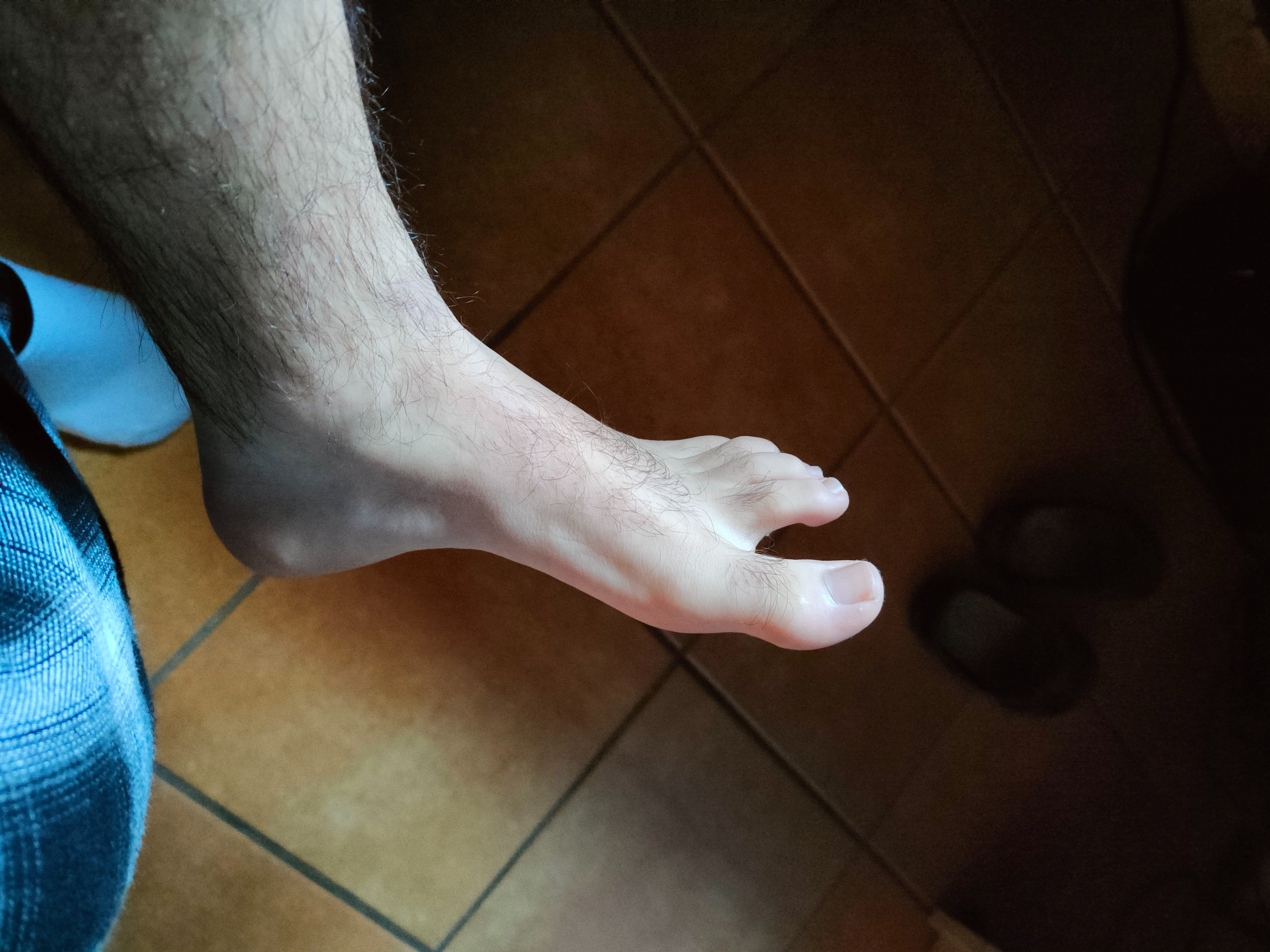 feets_onion thumbnail