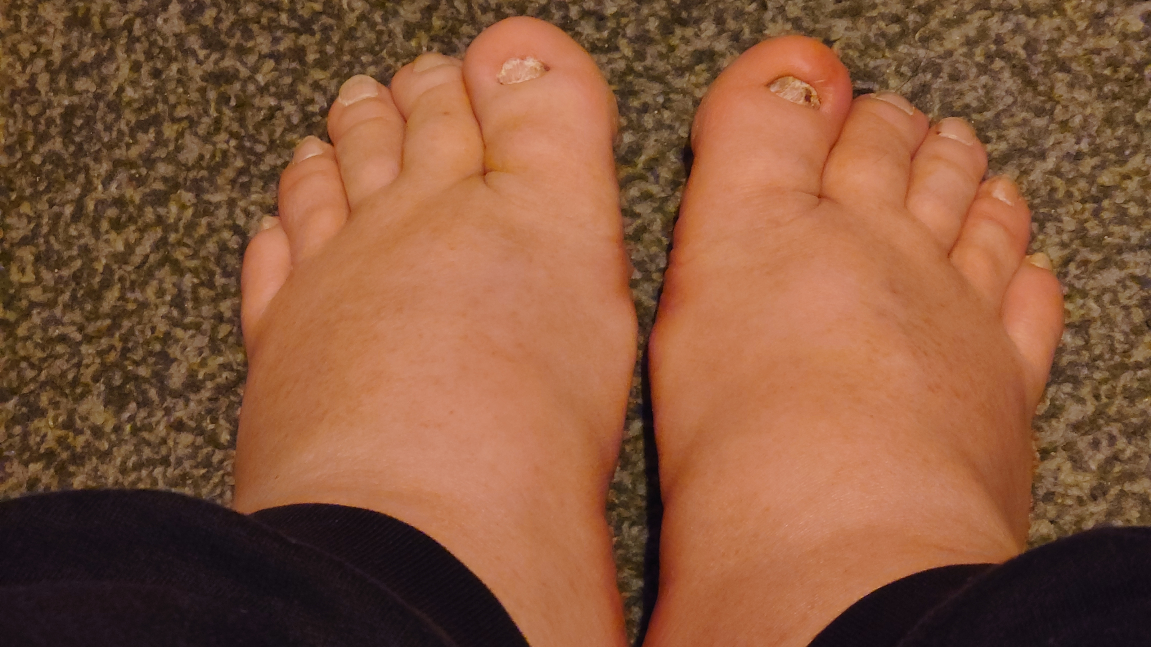 Fat feet. profile